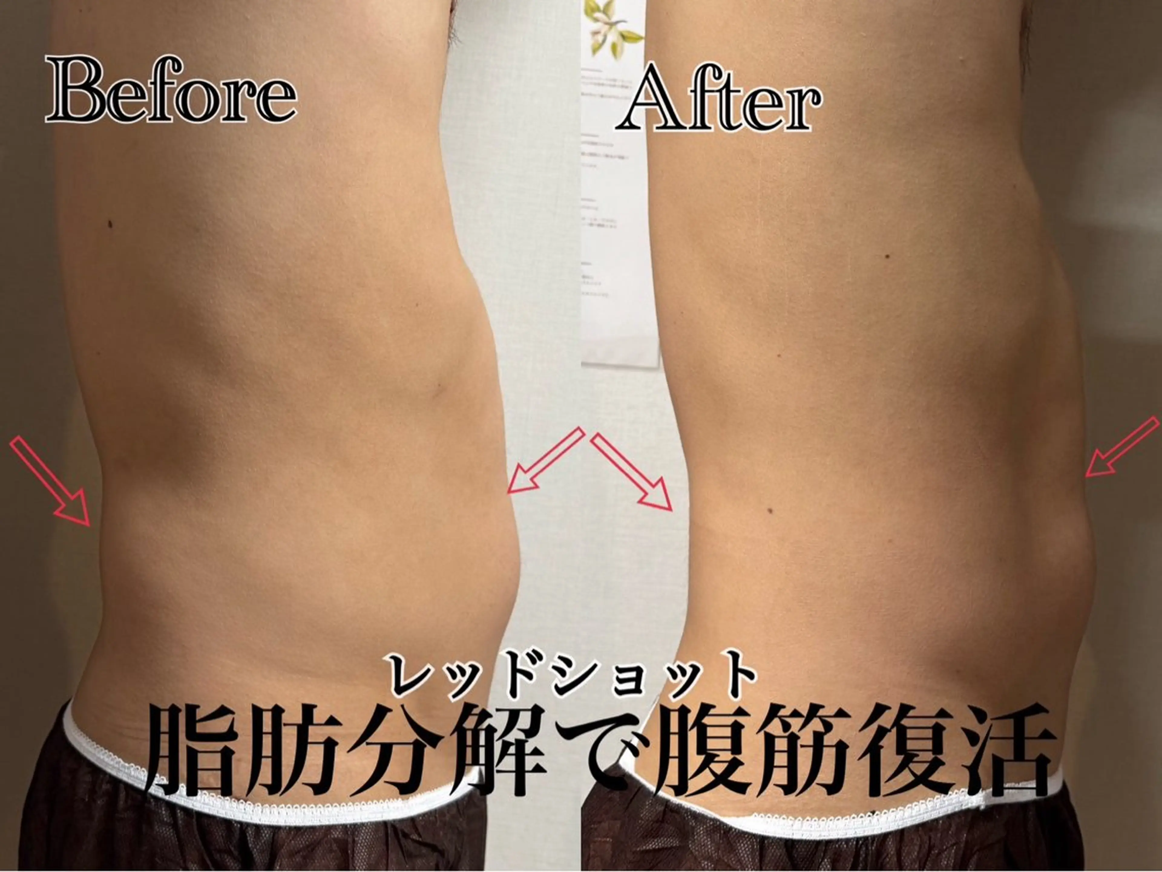 六本木脱毛andS さおりのエステ・リラクイメージ