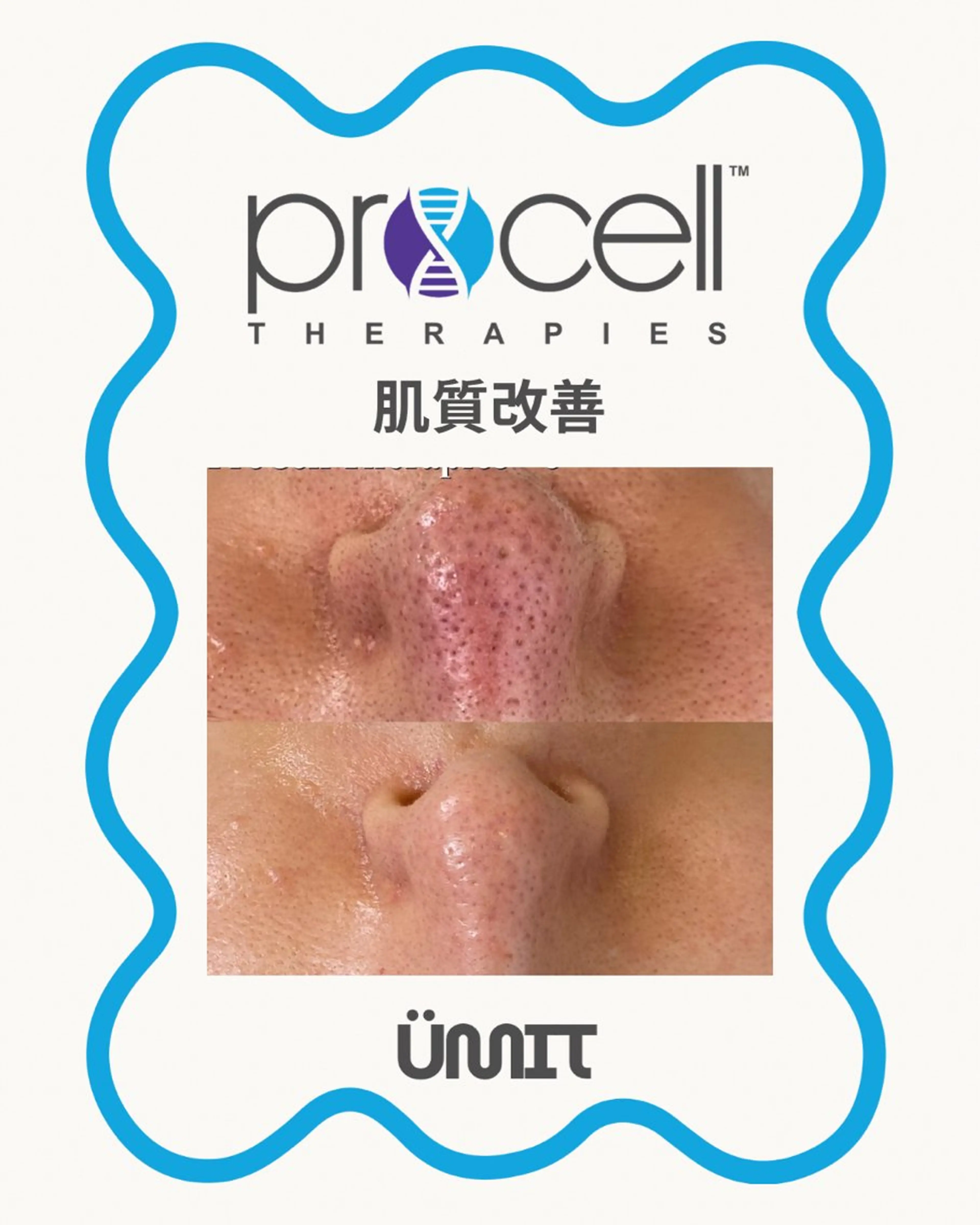 エステ Ümit（ユミト） プロセルセラピーズのネイルデザイン