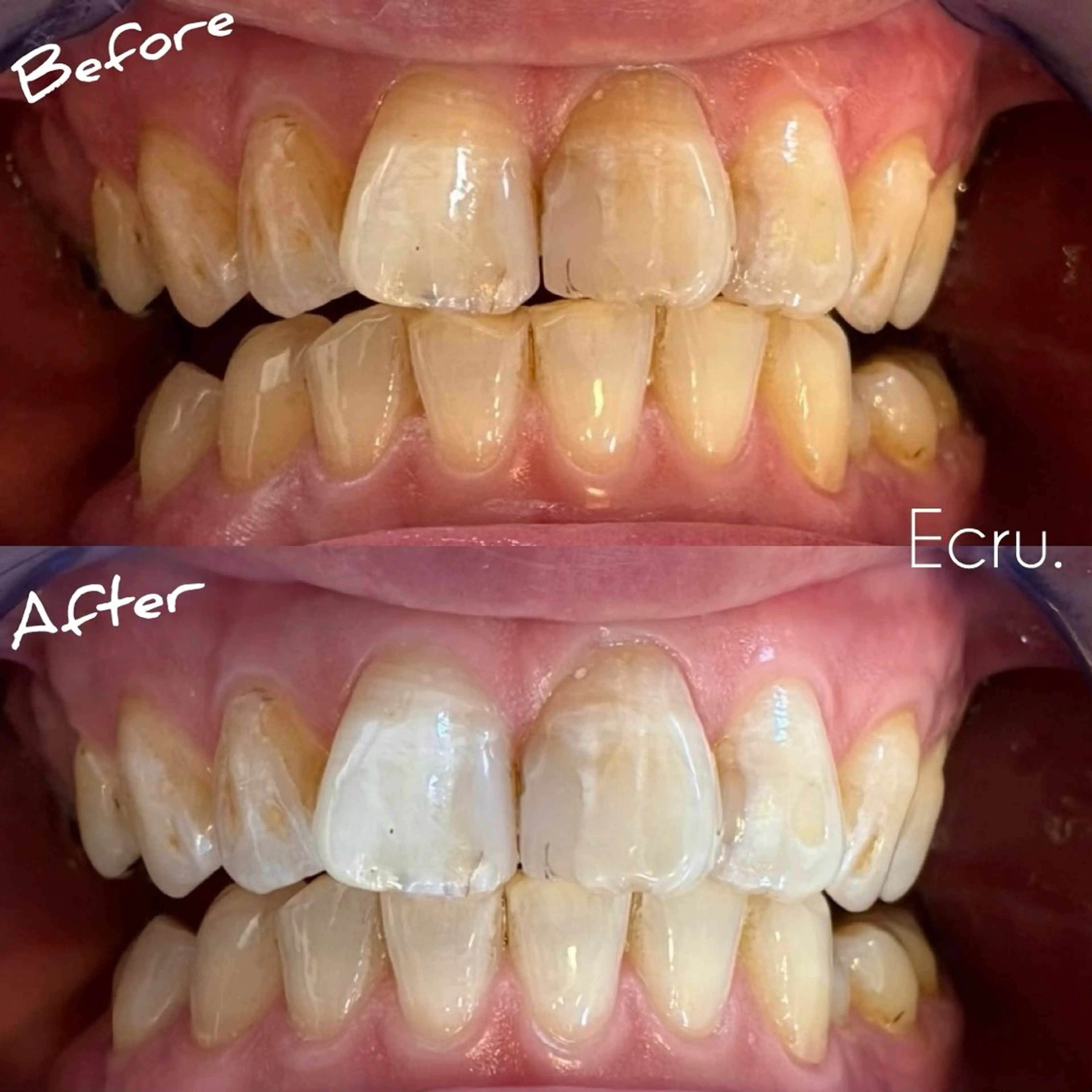 メンズ キッズ ホワイトニングサロン Ecru エクリュのその他イメージ