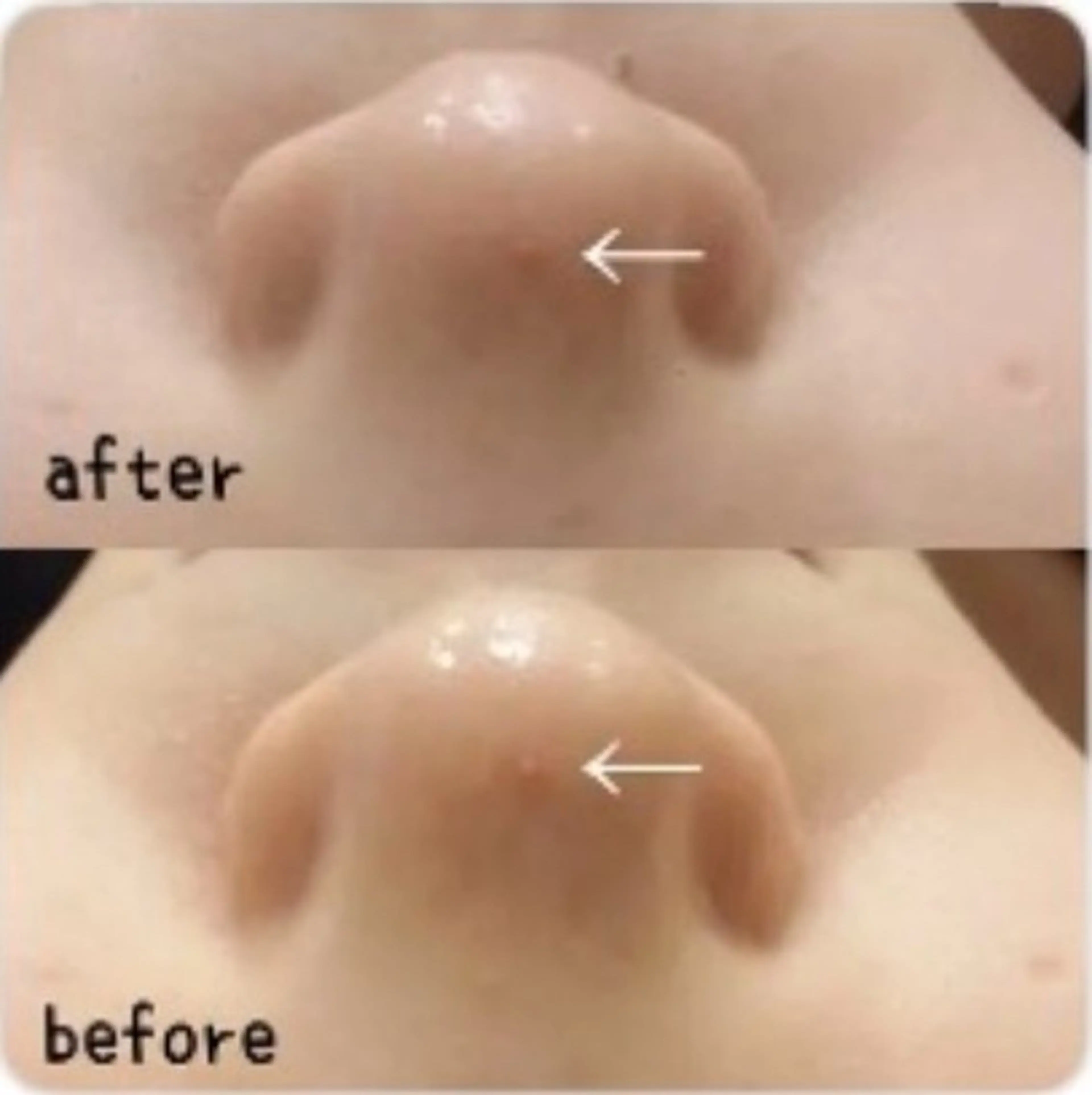 毛穴洗浄＆ハーブピーリング✨の写真