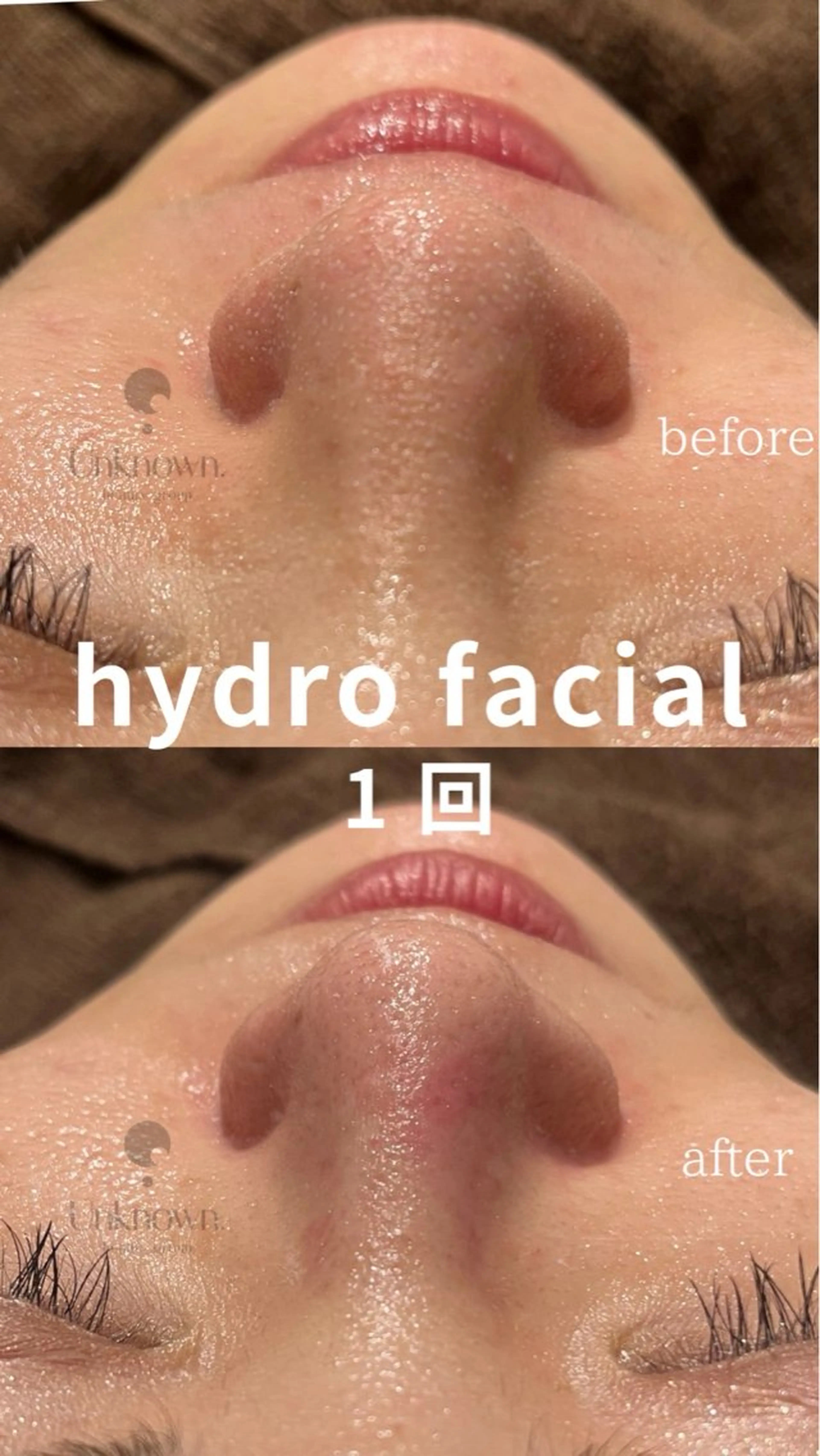 Unknown. なゆのマツエク・マツパデザイン