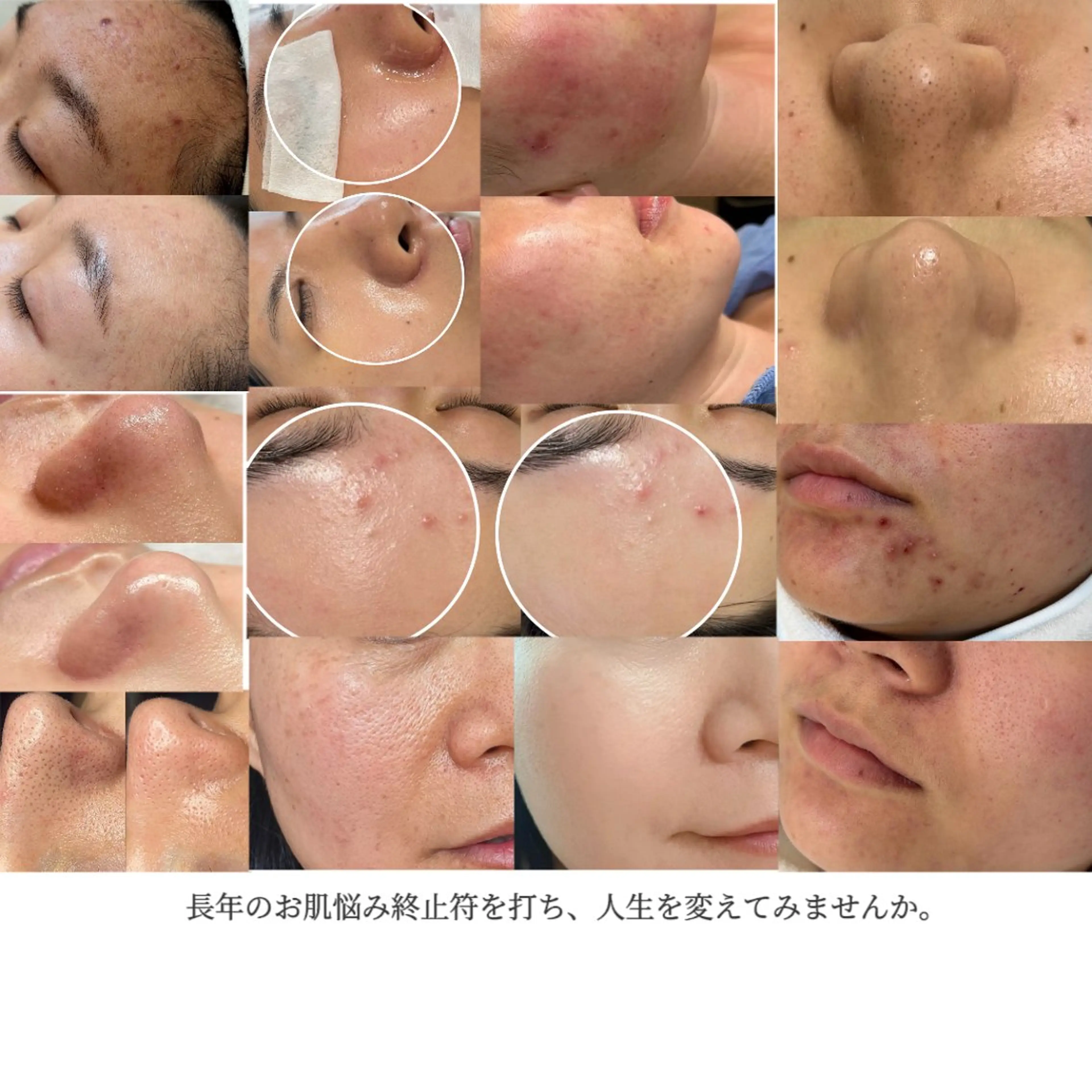 LUMINA ESTHのエステ・リラクイメージ