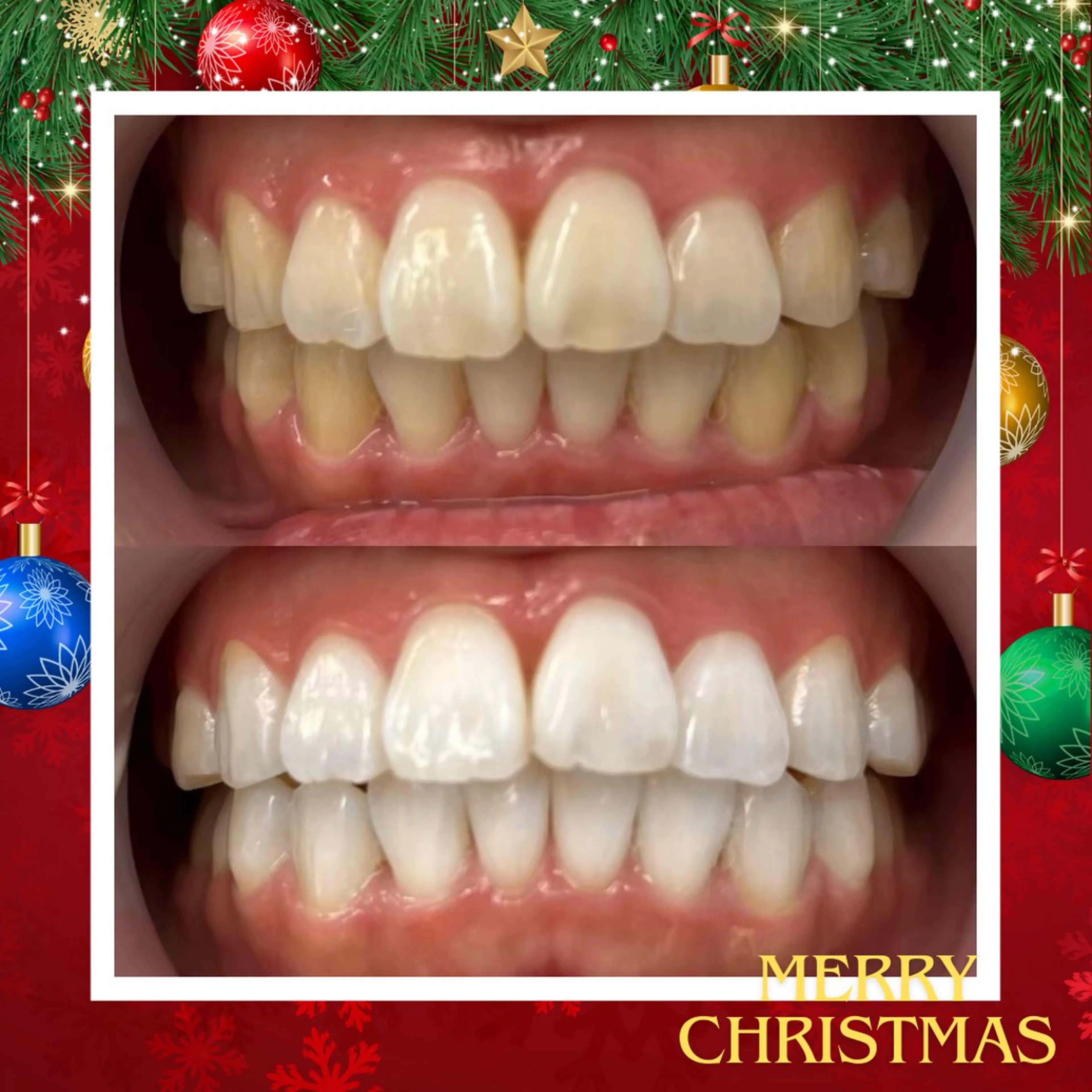 LBSホワイトニング 🌐 上野店公式のエステ・リラクイメージ