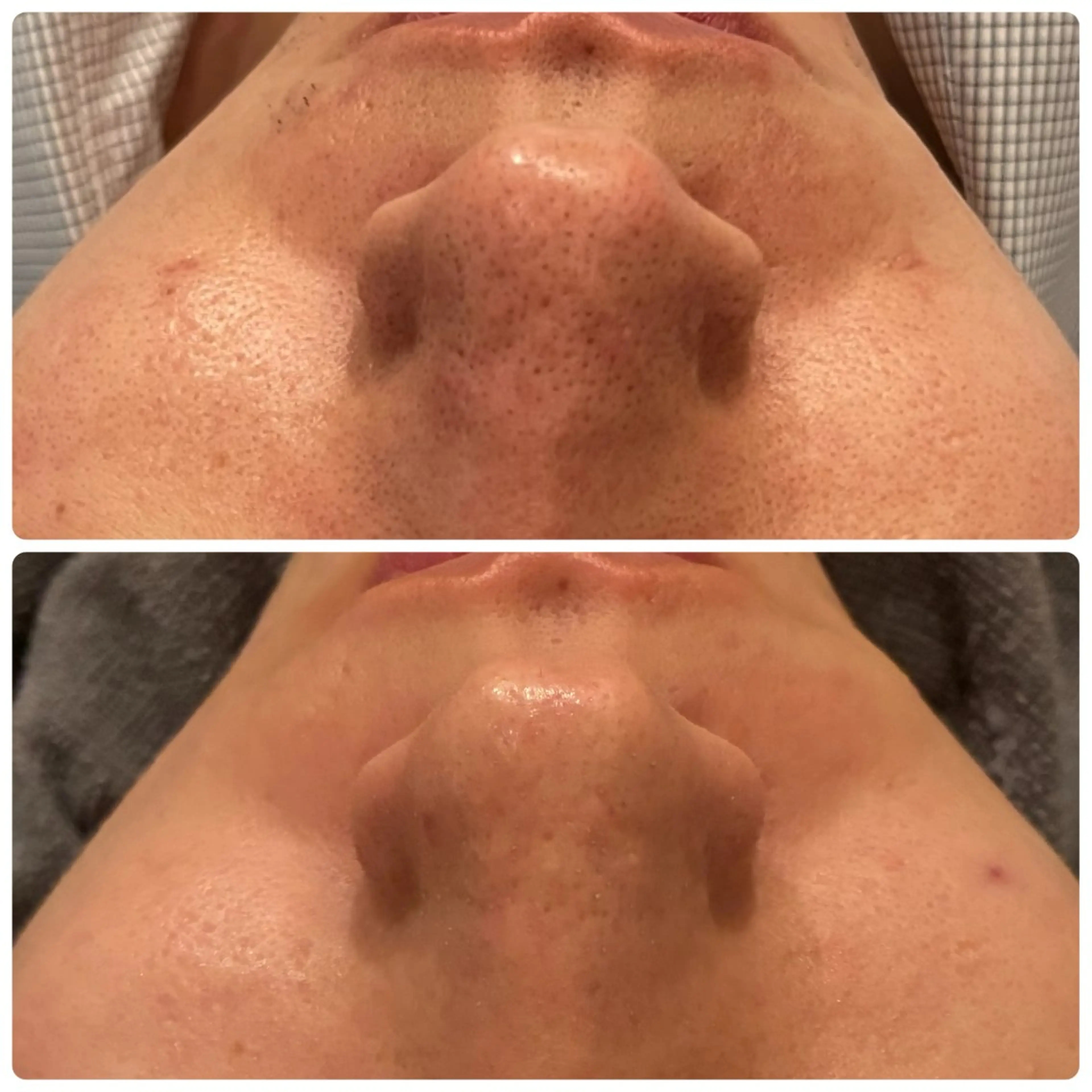 脱毛 yellow.所属・yellow💛【 脱毛&フェイシャル】のエステ・リラクイメージ