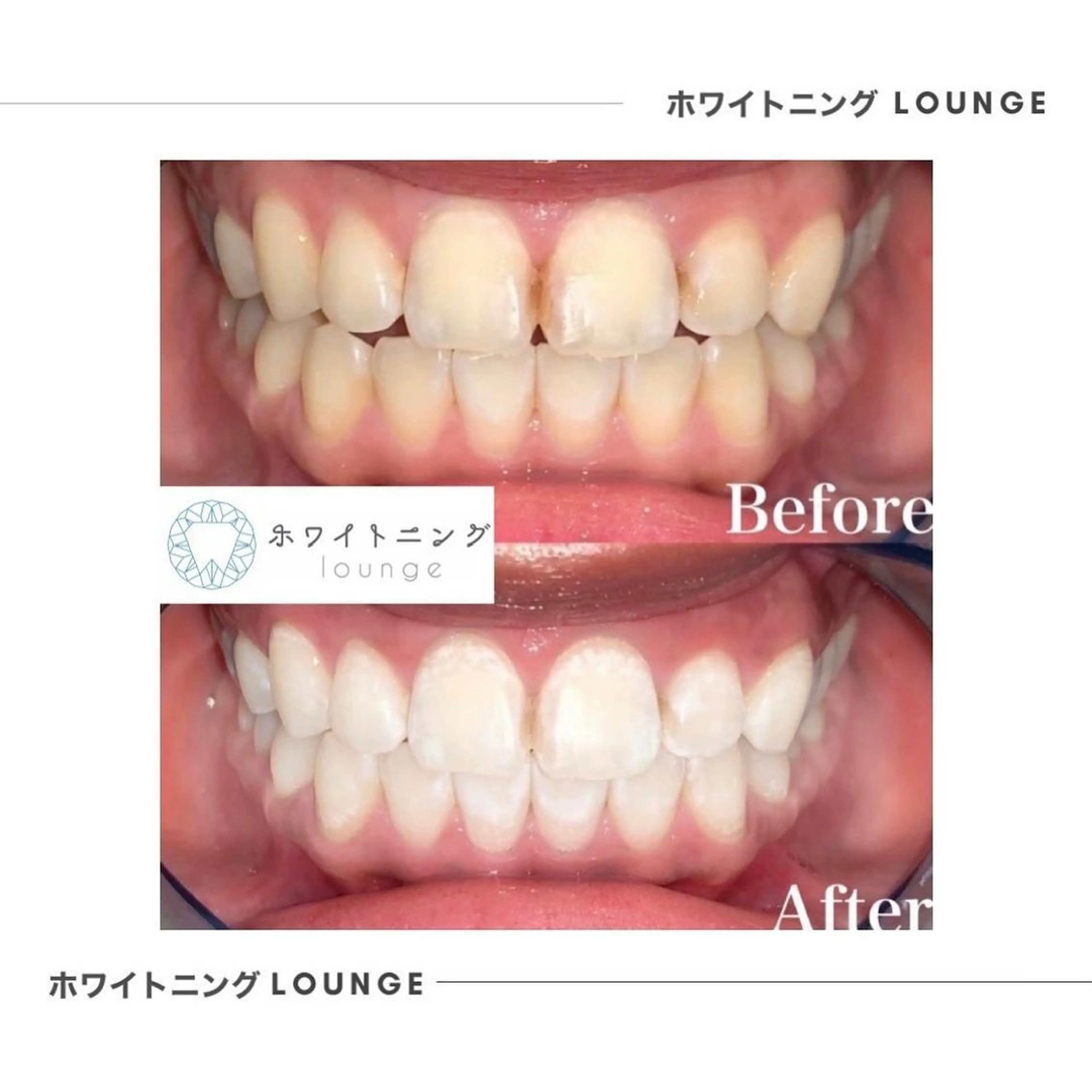 ホワイトニング Lounge横須賀のエステ・リラクイメージ