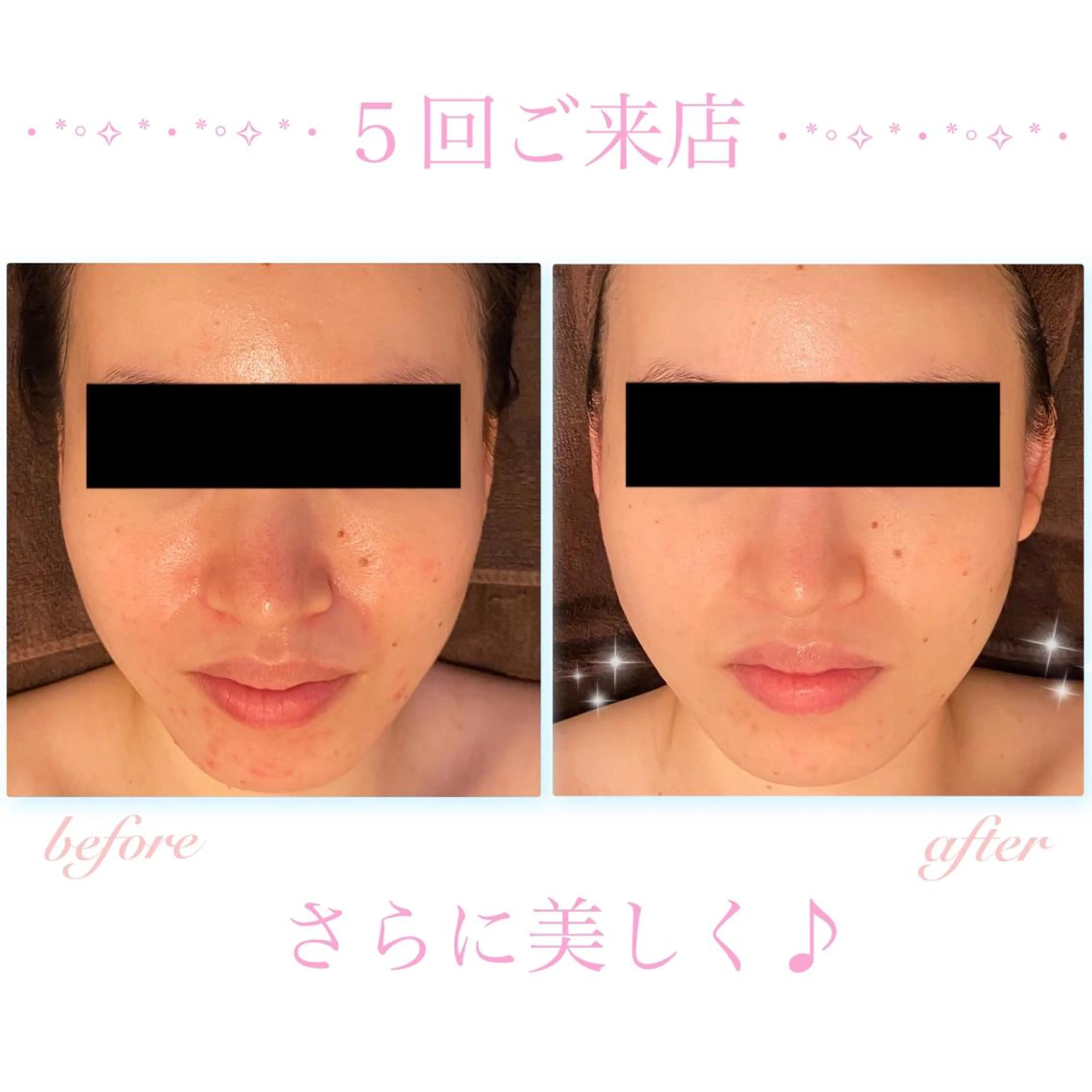 エステ リラク ダイエット・美肌ケア fleurのエステ・リラクイメージ