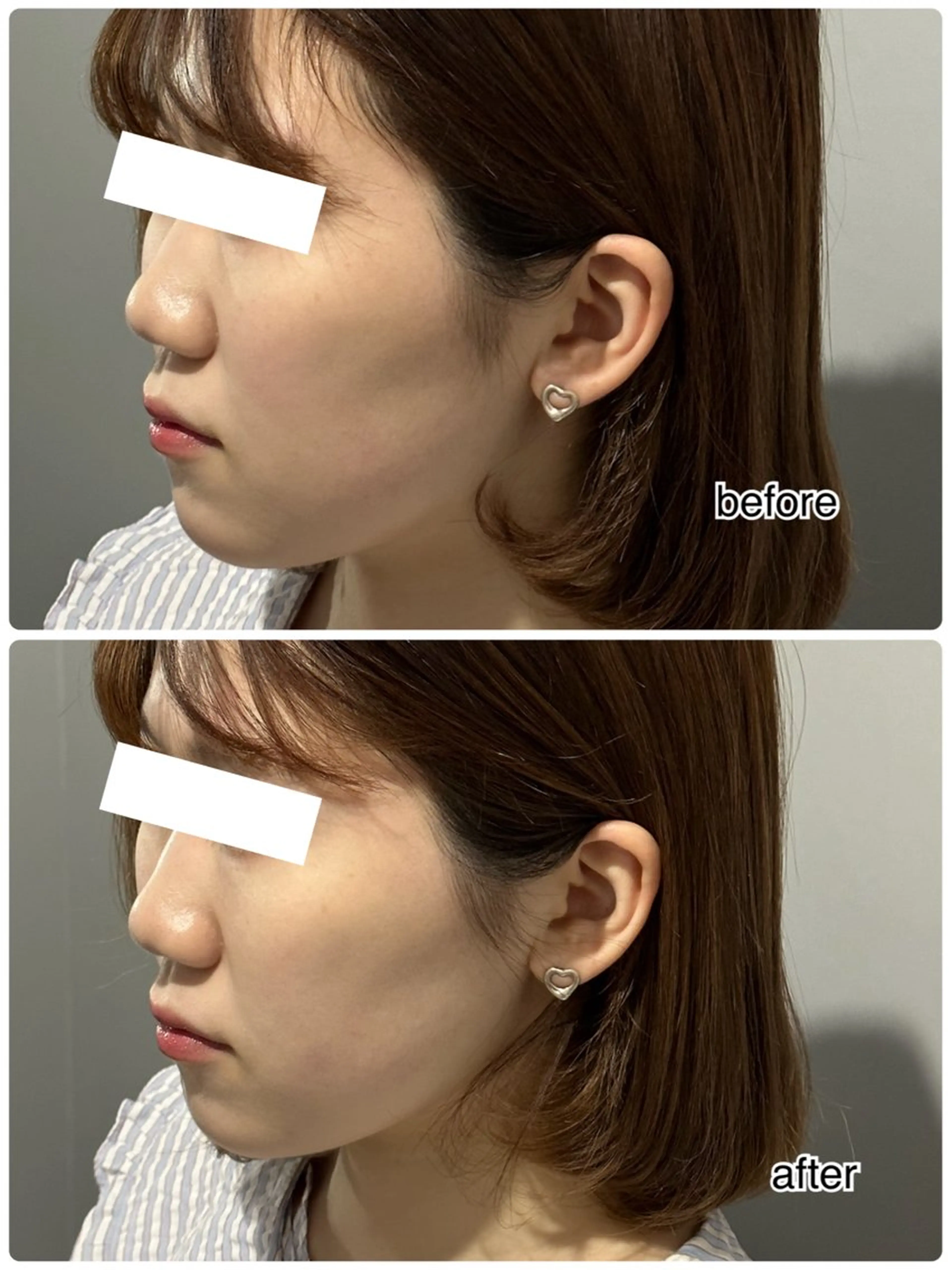 エステ ENCHANT 脱毛.小顔.毛穴のエステ・リラクイメージ