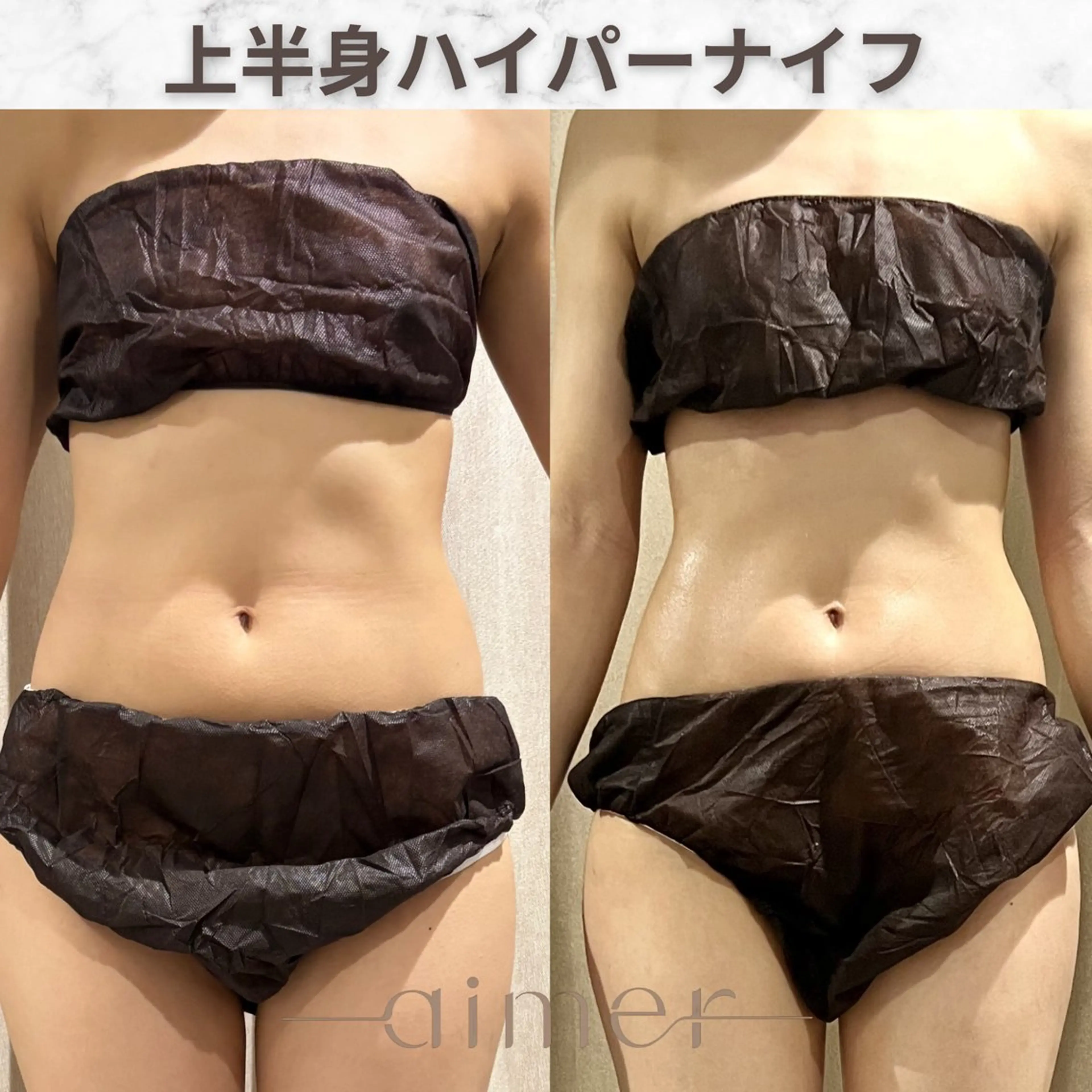 aimer服部 /  小顔 ・ 痩身のその他イメージ