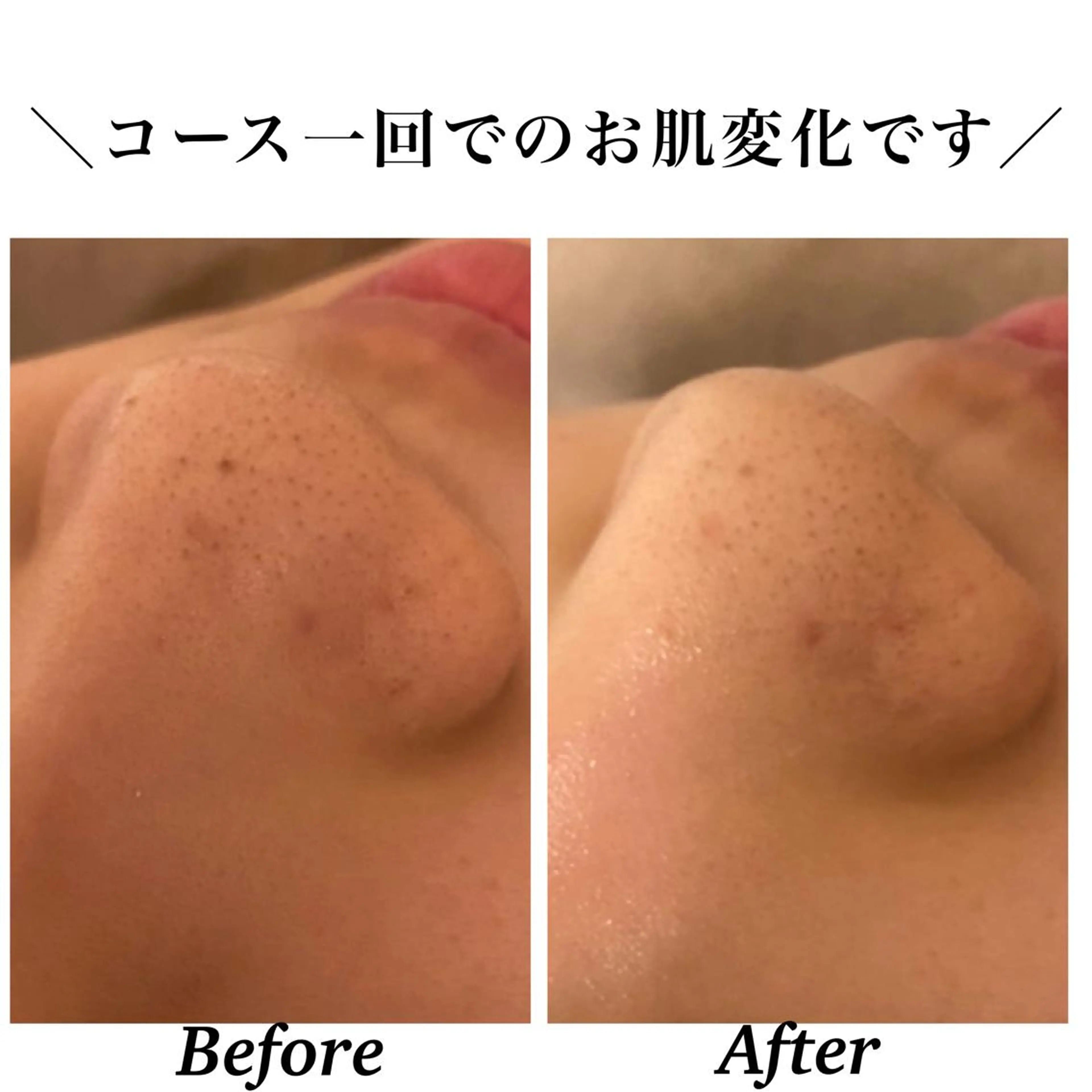 エステ リラク Bellesthe （ベルエステ）のエステ・リラクイメージ