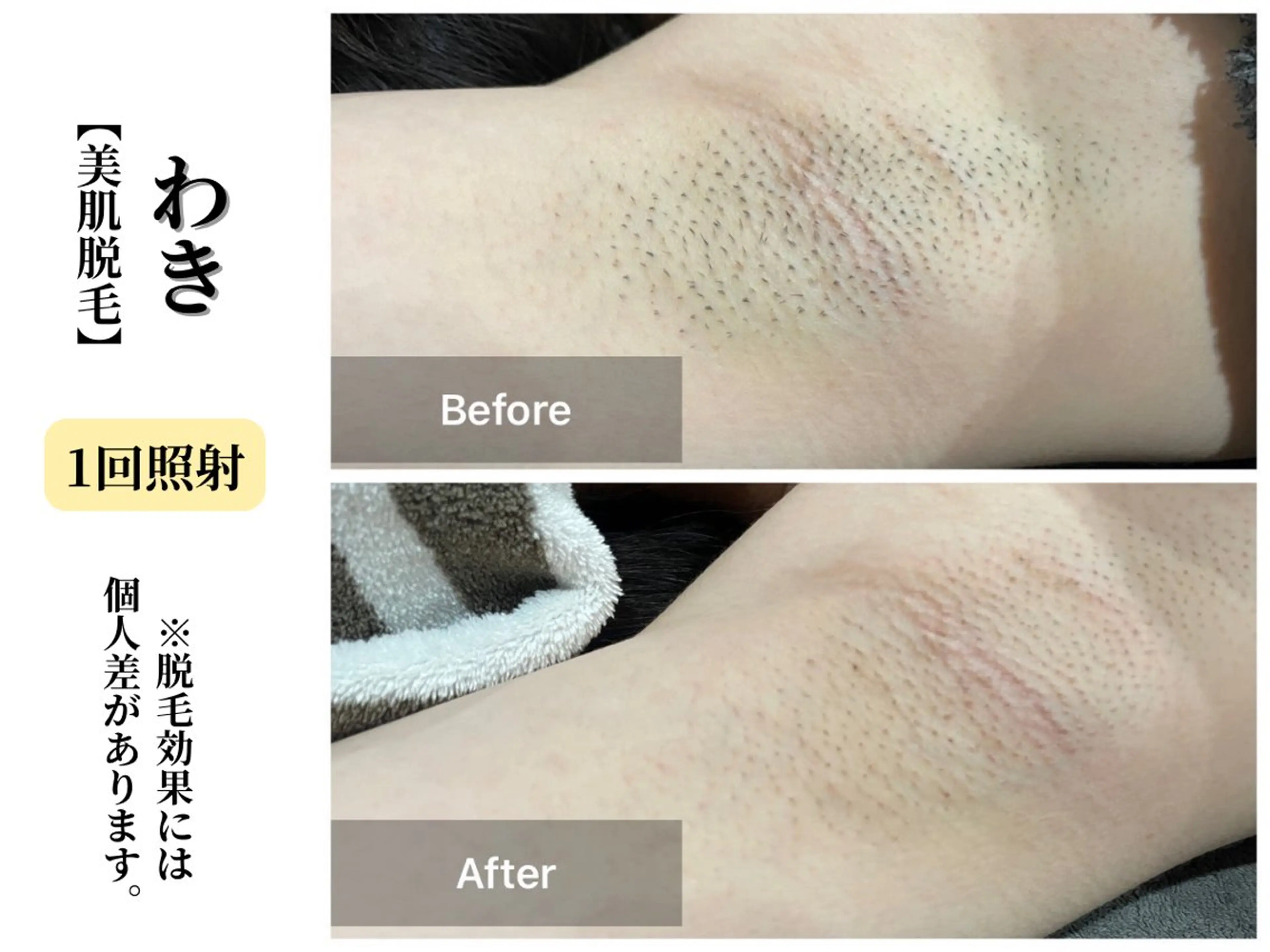 脱毛 本格痩身＊透明美肌 BelleWhiteのエステ・リラクイメージ