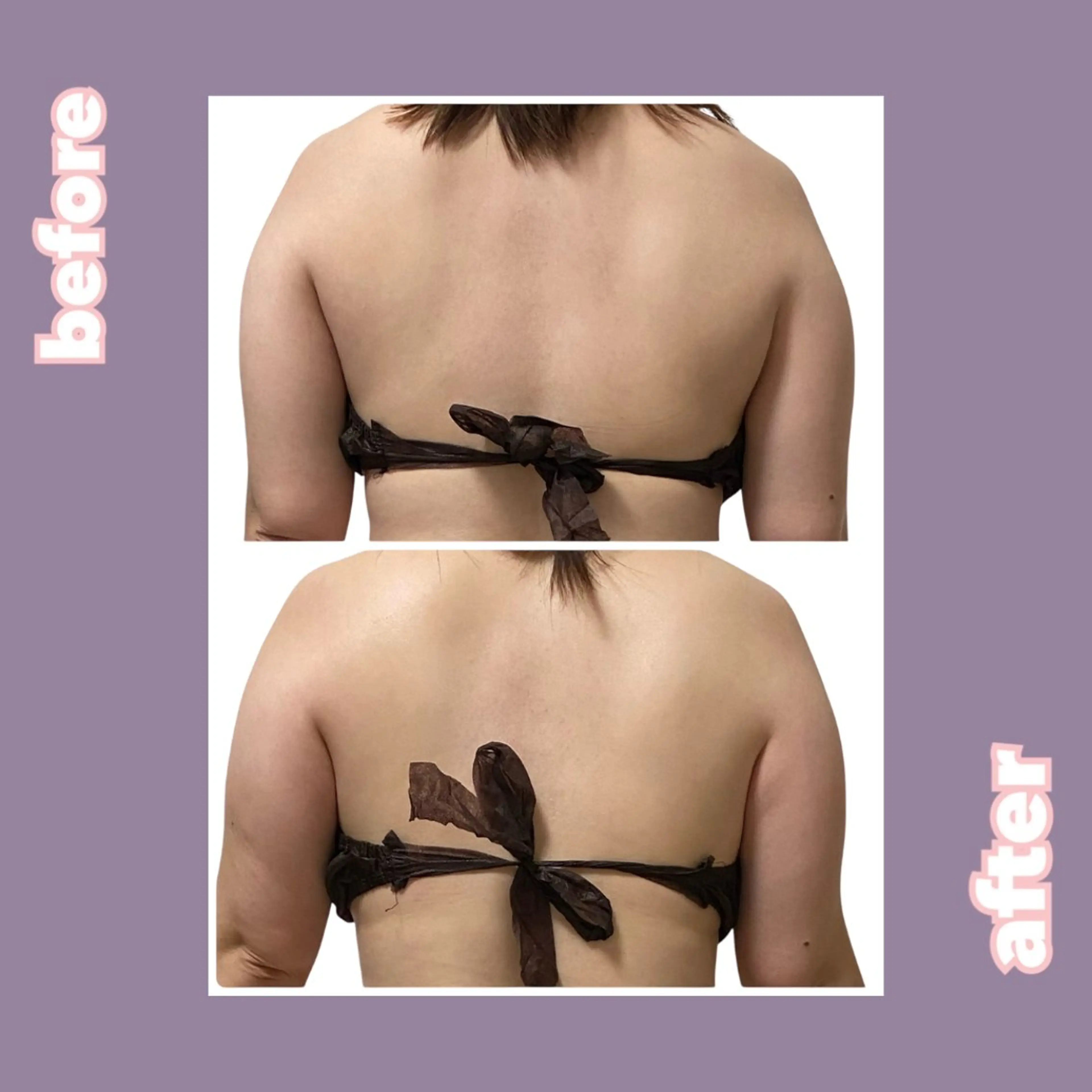 30分【太って見える原因は背中？👀】上半身集中ケアコース💪の写真