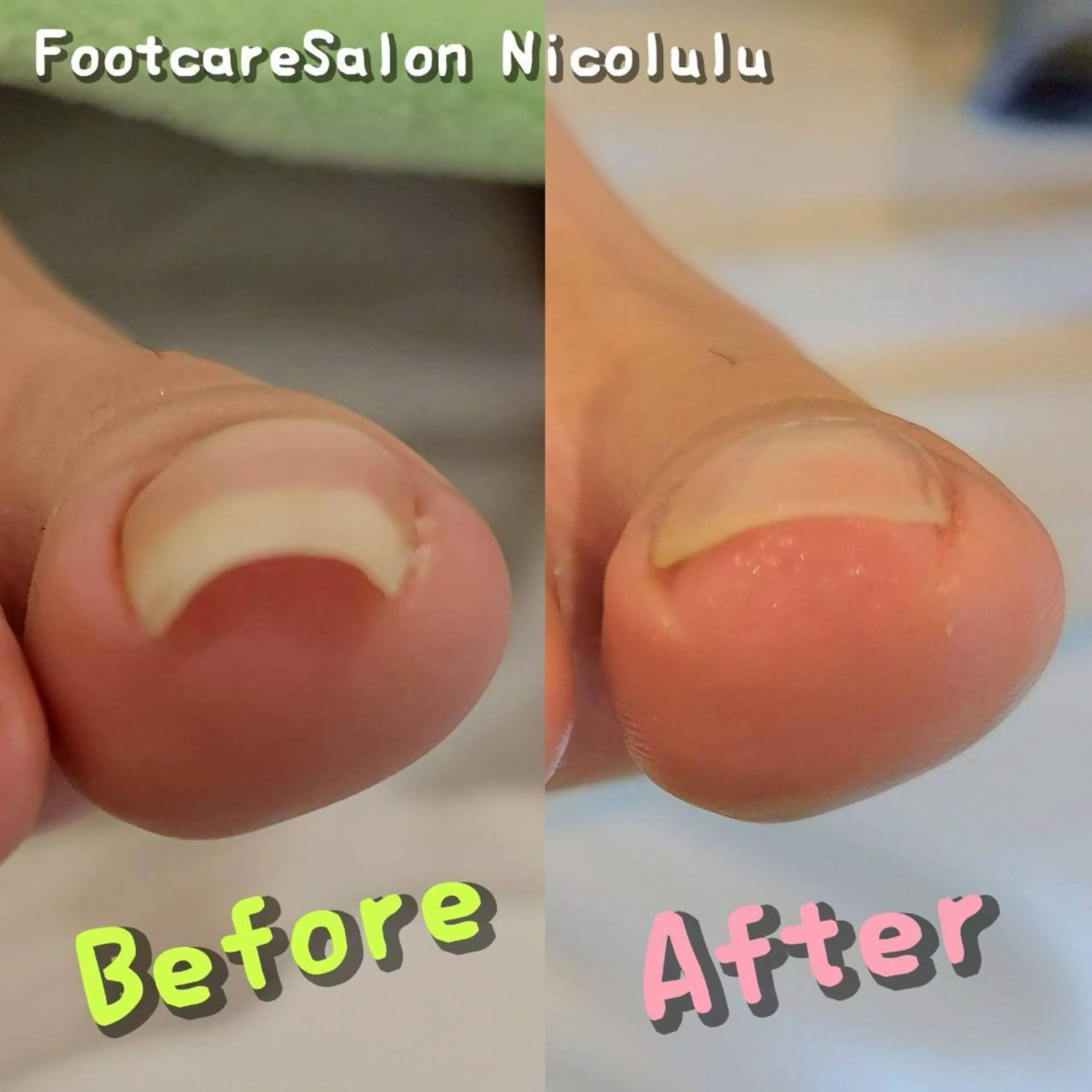 リラク 足トラブル専門 ニコルル金沢のエステ・リラクイメージ