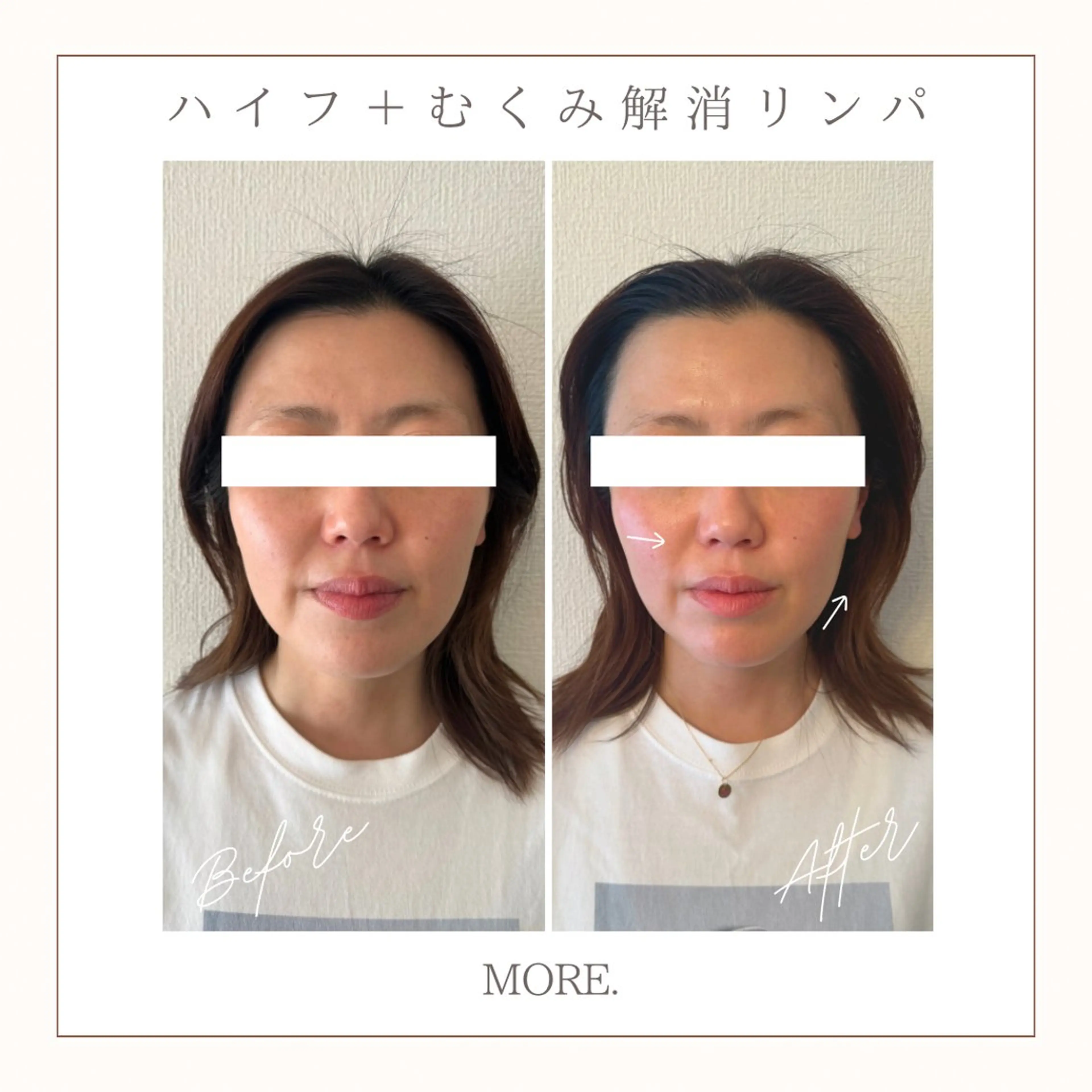 MORE. NEMAのエステ・リラクイメージ