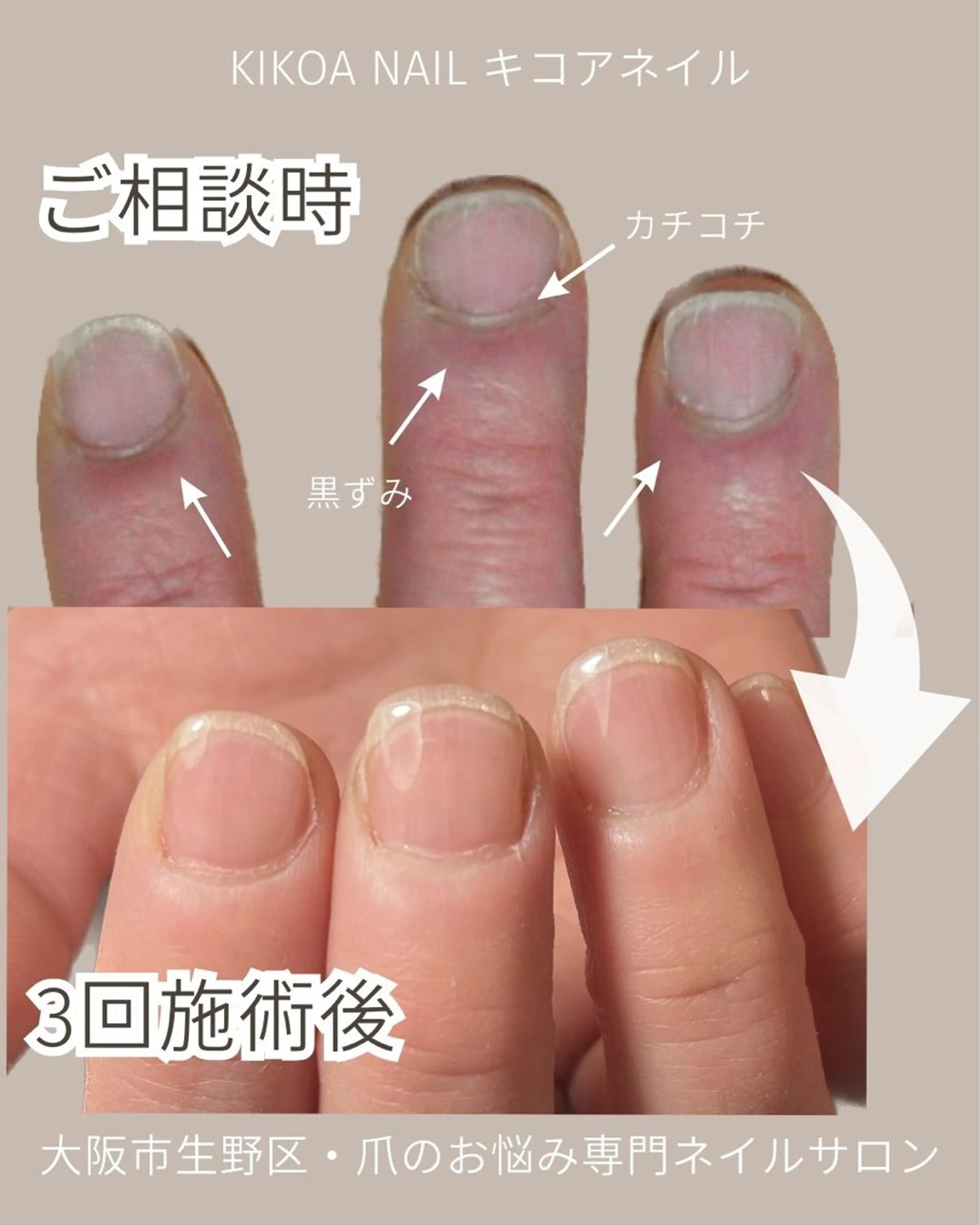 ネイル KIKOA NAIL キコアネイルのネイルデザイン