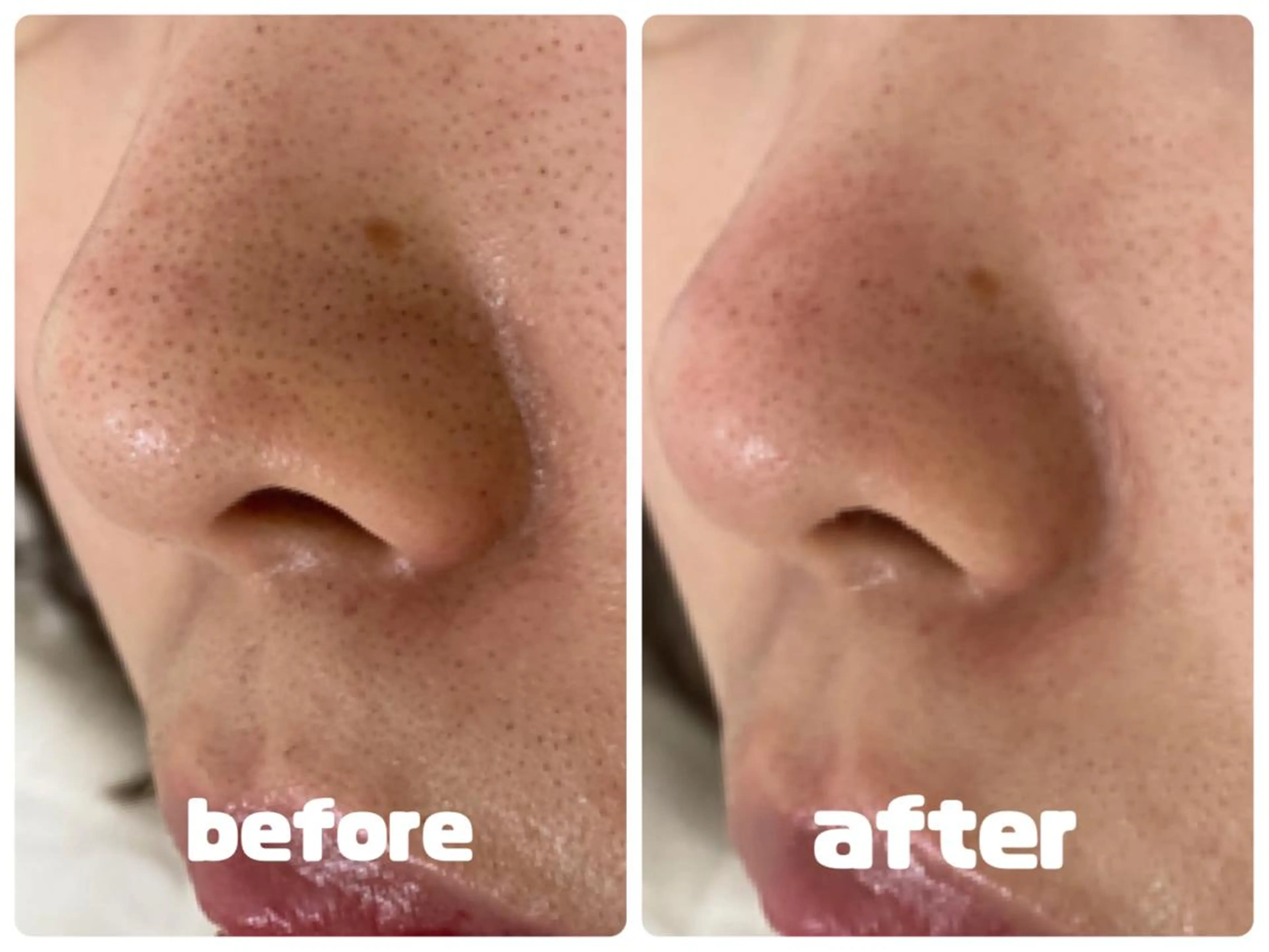 tutti所属・t uttiのマツエク・マツパデザイン