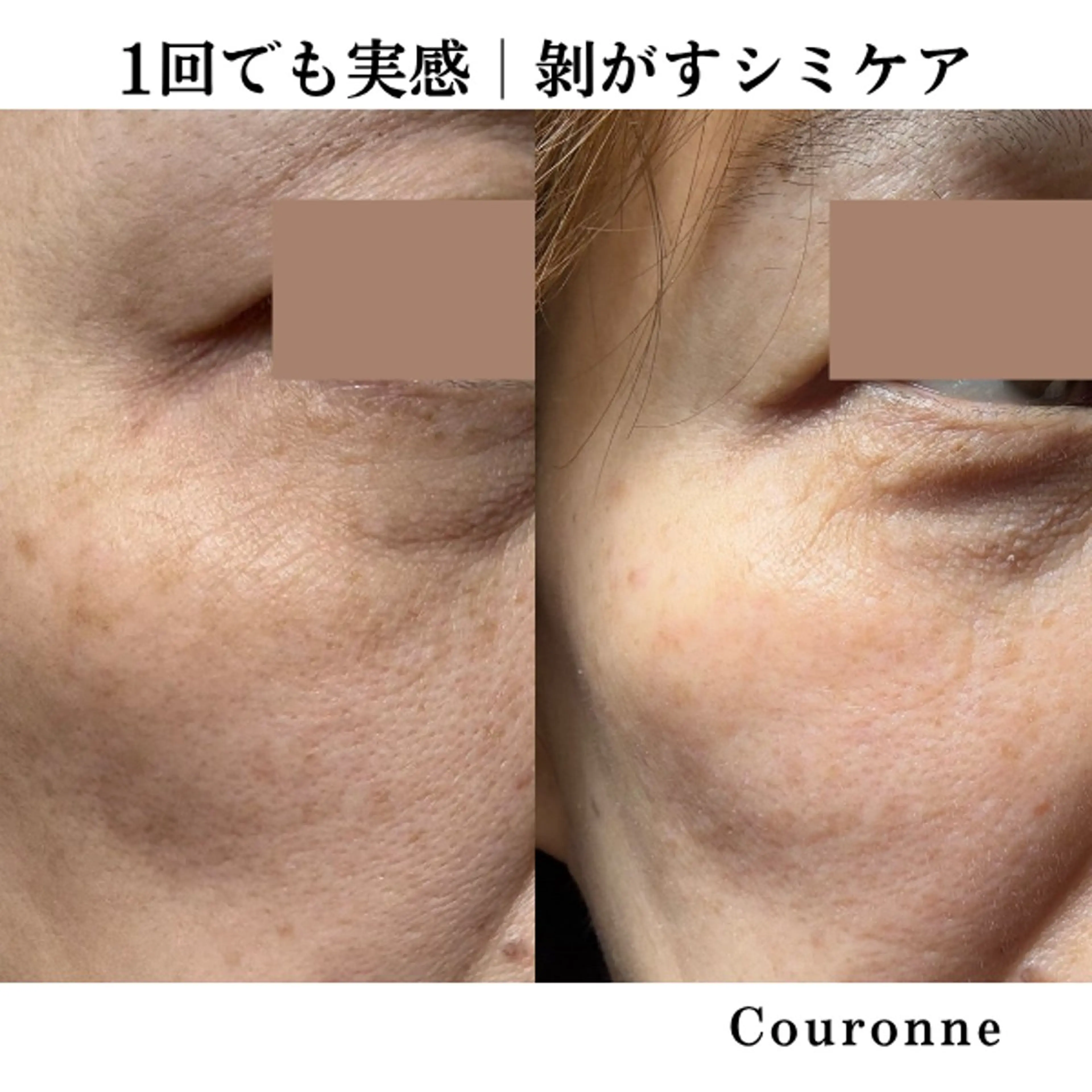 エステ シミ・毛穴ケア専門 クロヌYUKIのエステ・リラクイメージ