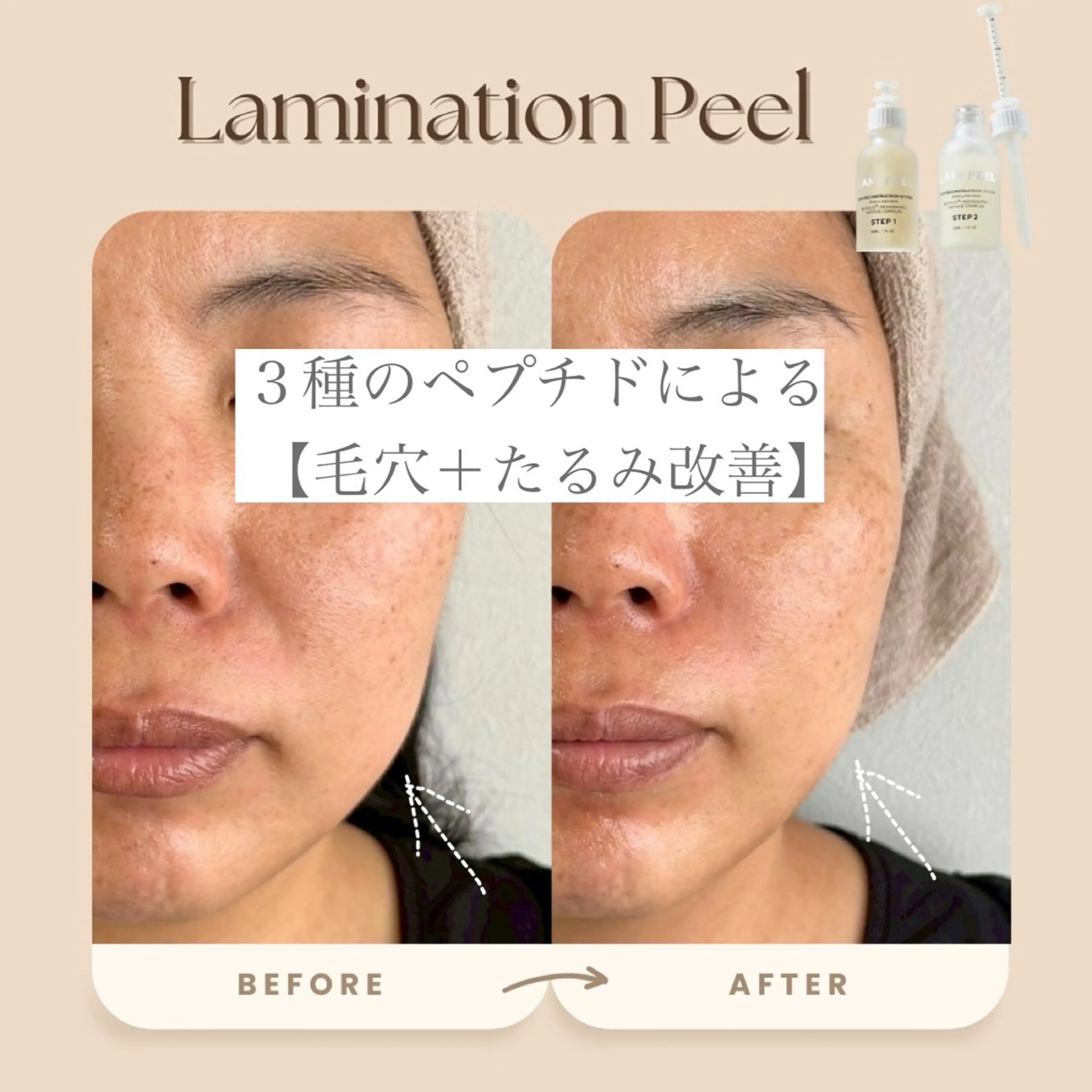 hue. YUKAのエステ・リラクイメージ