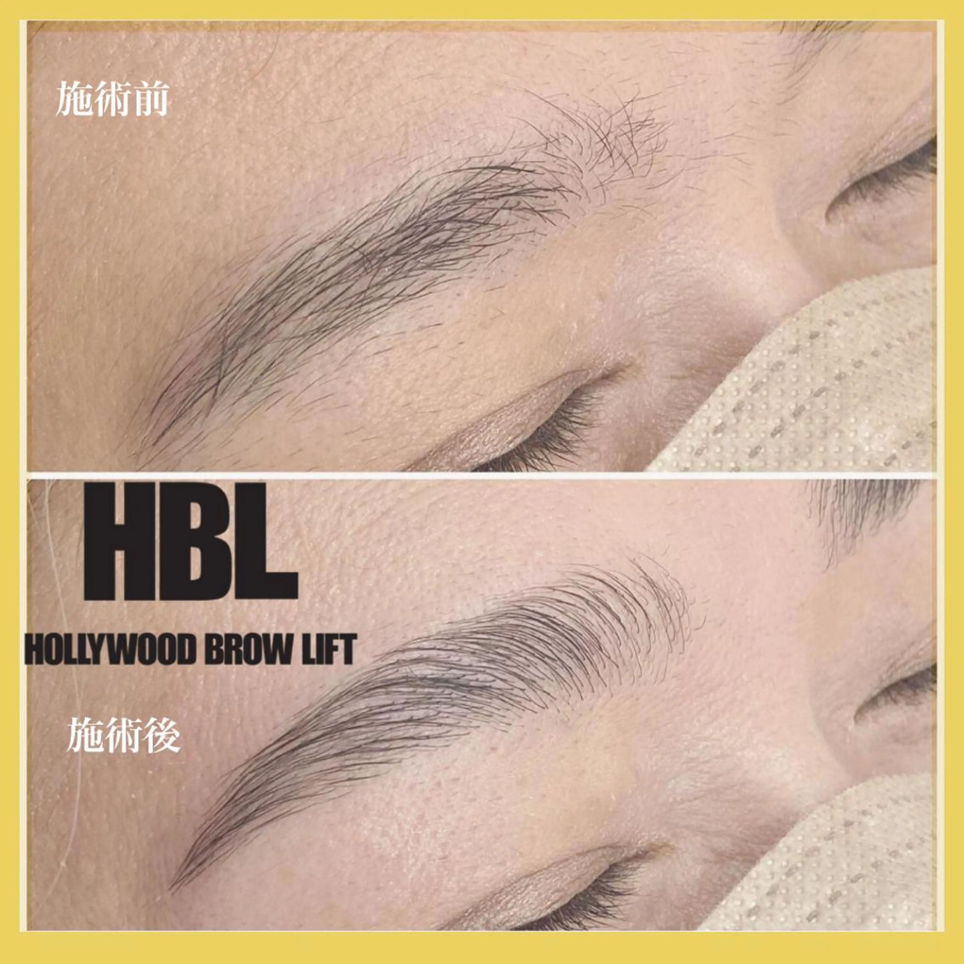 アイブロウ その他(アイブロウ) epismoo 脱毛/HBL/毛穴の眉毛・アイブロウイメージ