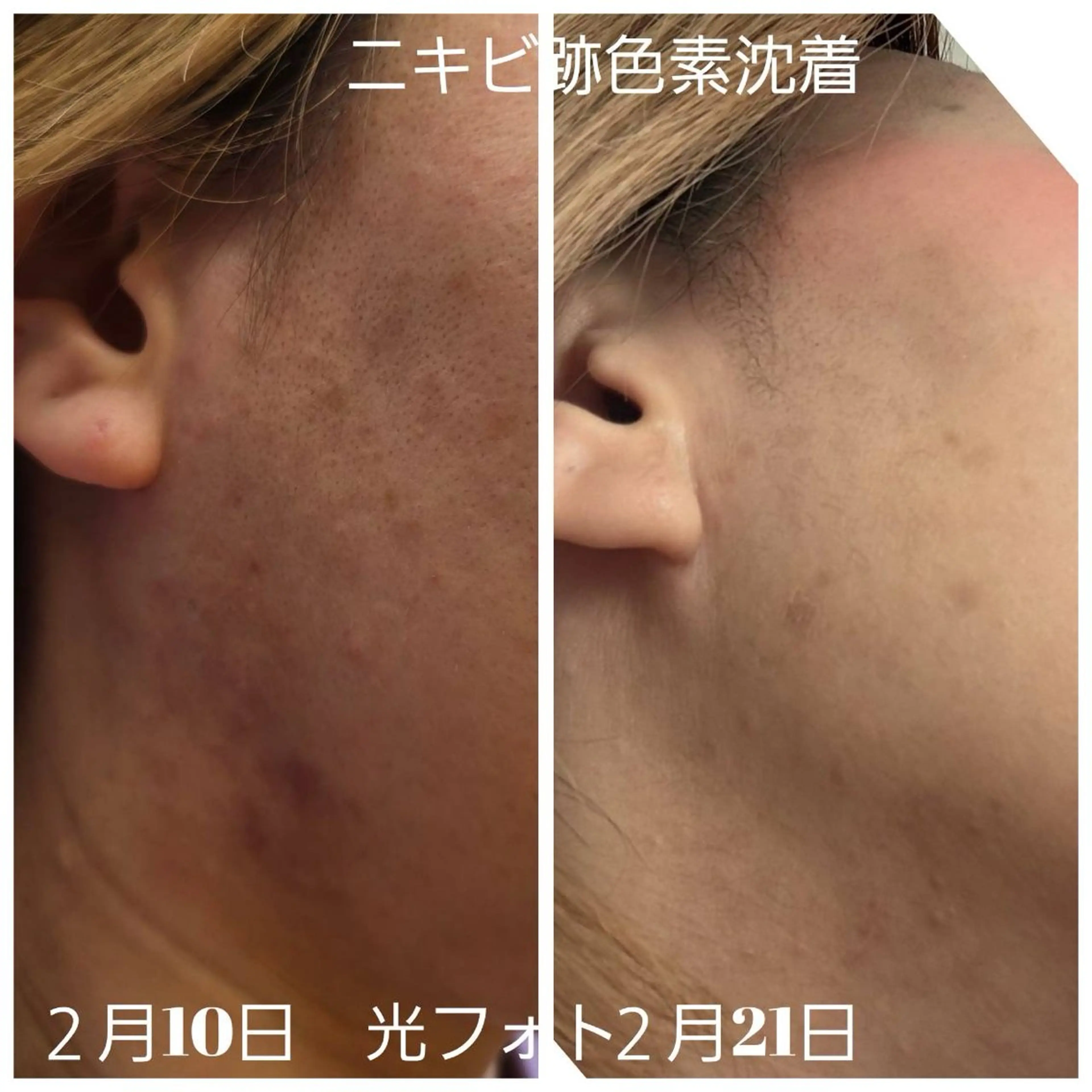 ilima NARUMIのエステ・リラクイメージ