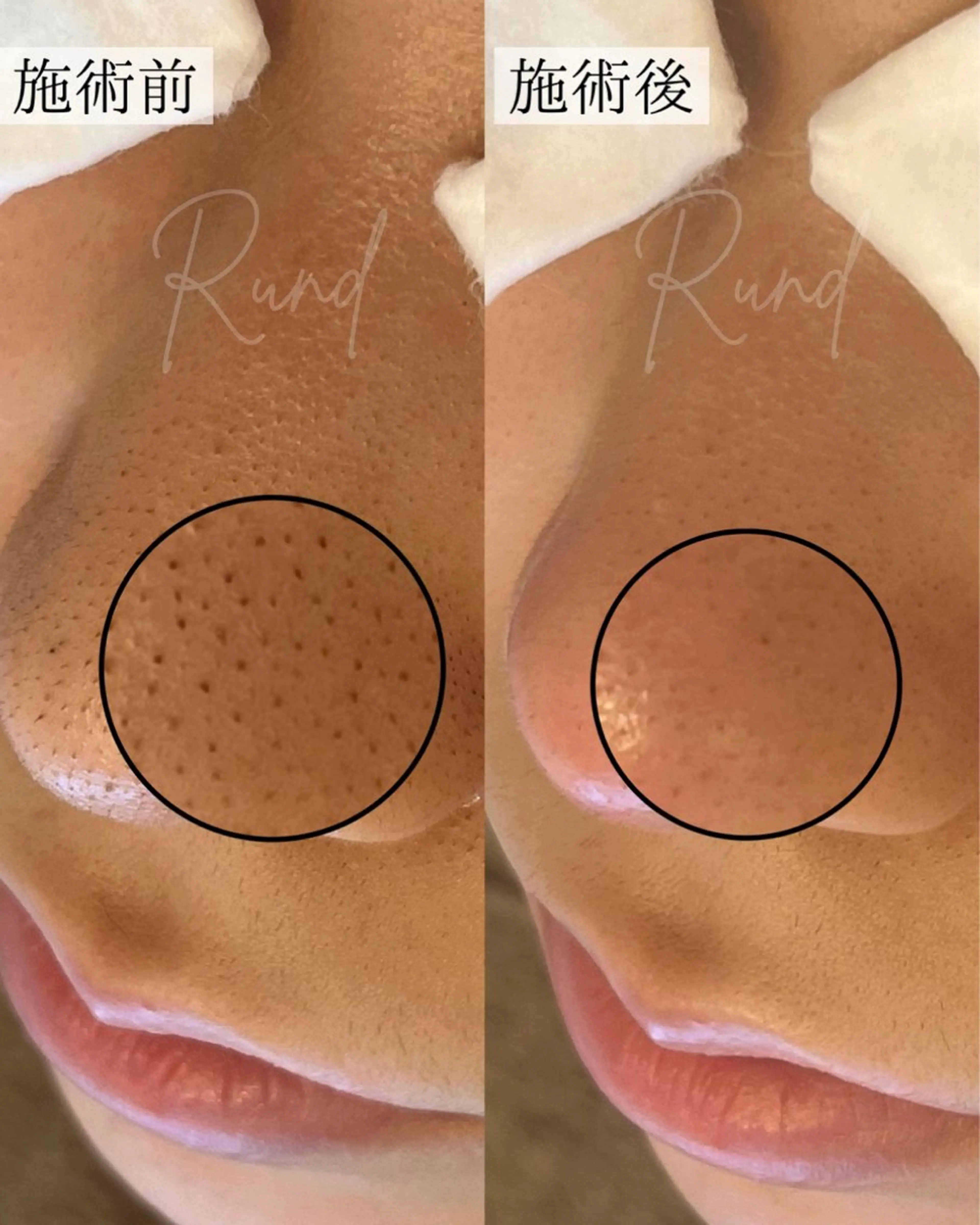 Rund（ラウンド） 自宅サロンのエステ・リラクイメージ