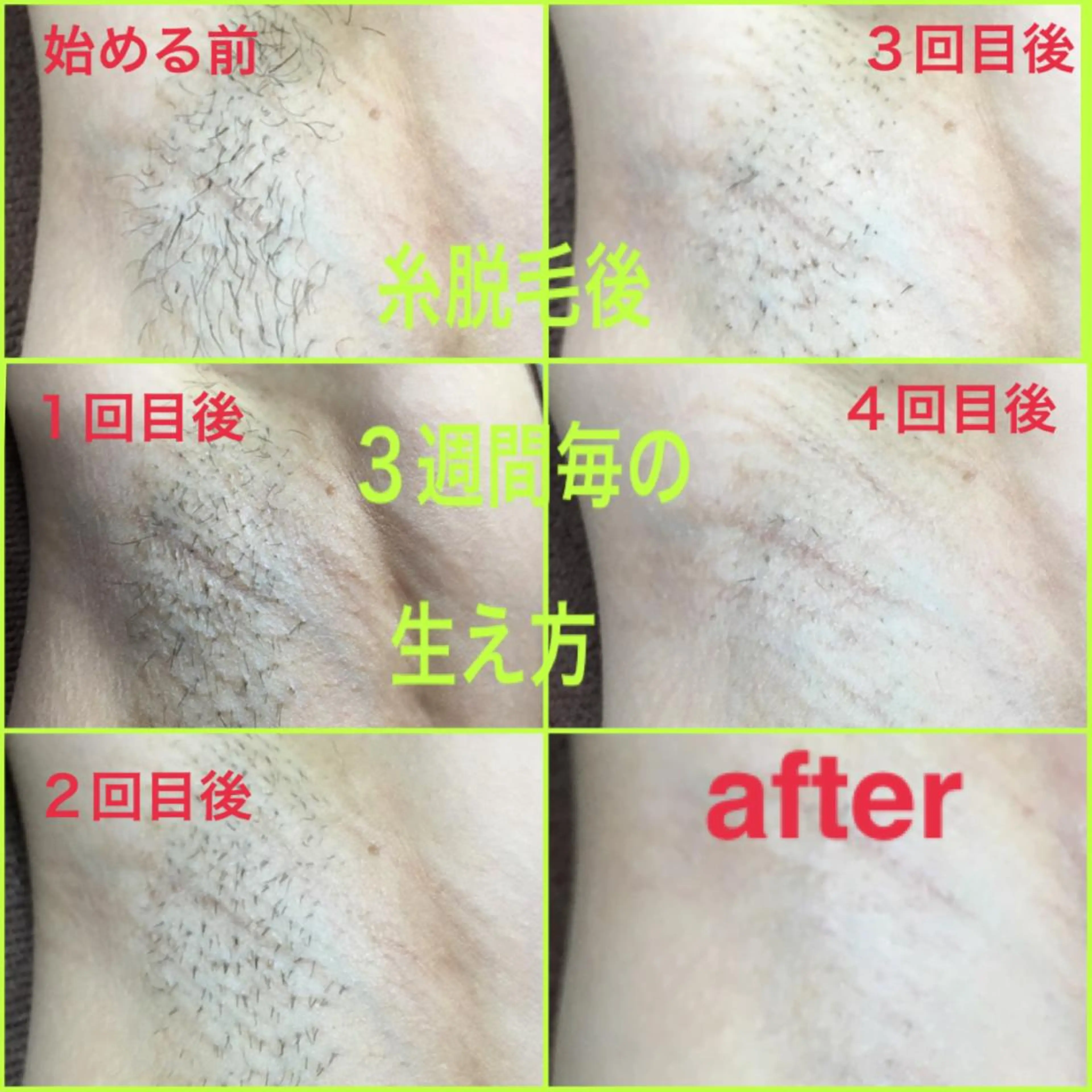 脱毛 金沢金箔糸脱毛®︎糸美しや〖𝑖𝑡𝑜𝑢𝑡𝑠𝑢𝑘𝑢𝑠ℎ𝑖𝑦𝑎〗所属・Nakamura Atsukoの眉毛・アイブロウイメージ