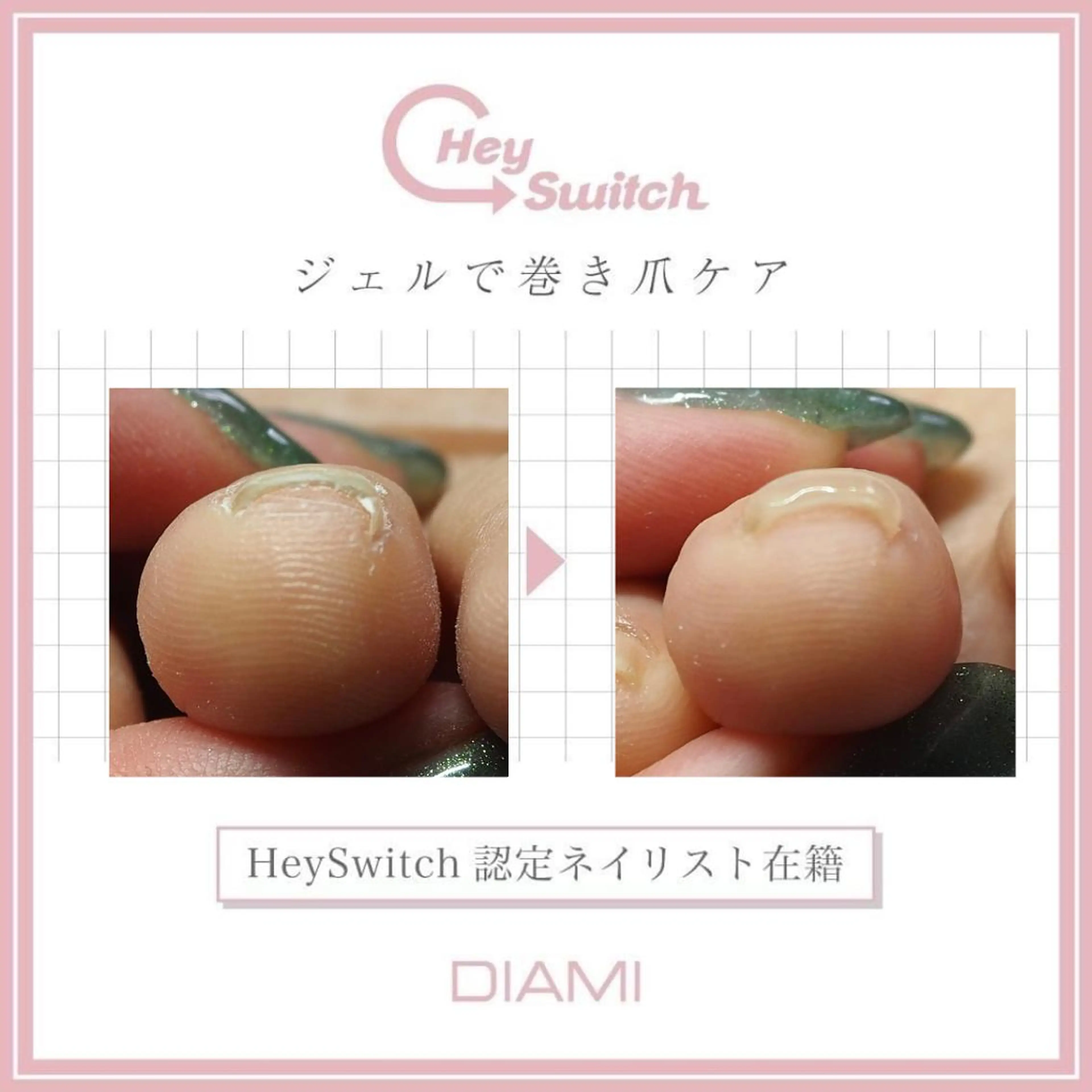 ネイル フットネイル Gatto(ガット) ヤマモトのネイルデザイン