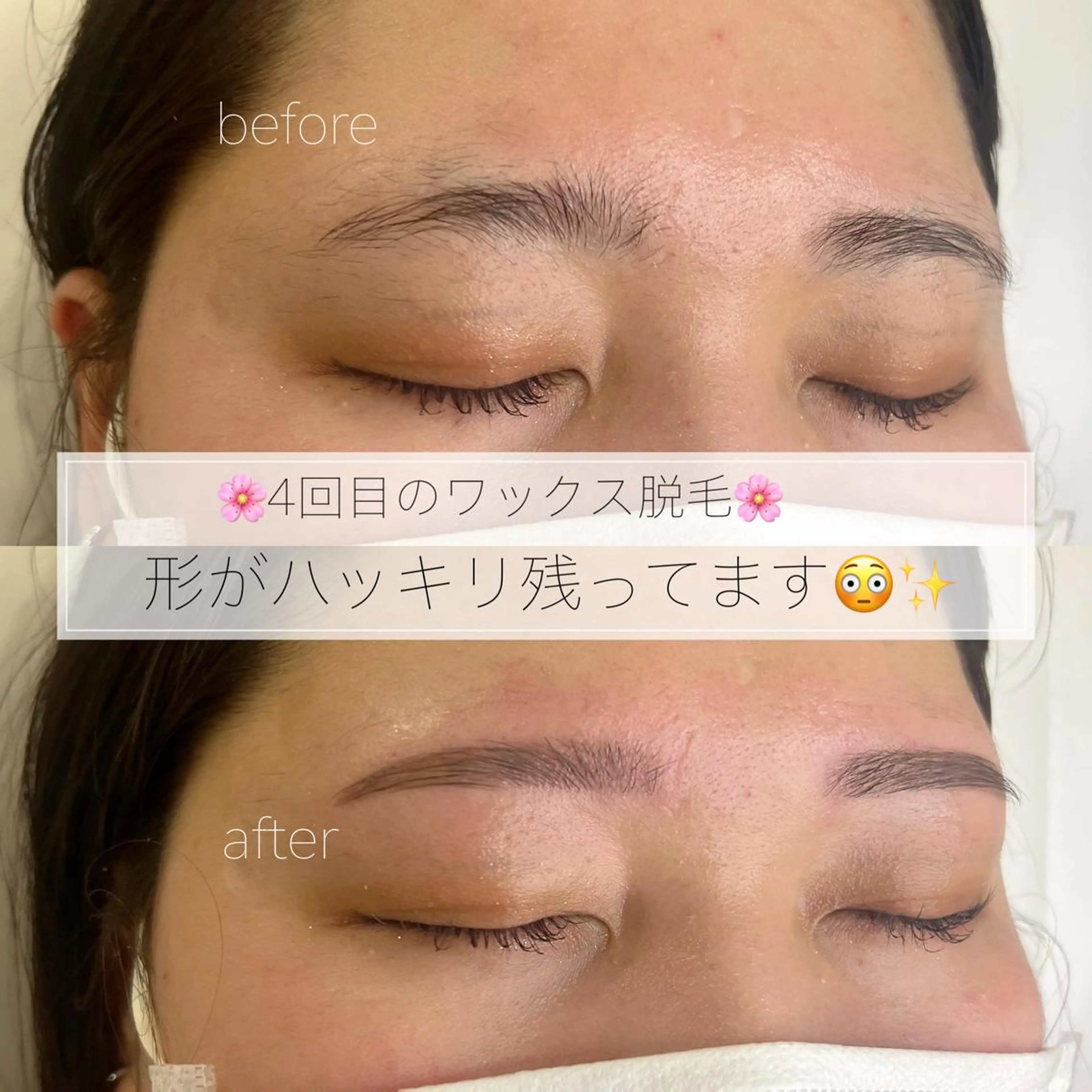 アイブロウ Lea堺東　毛穴洗浄 ×顔ワックス脱毛のその他イメージ