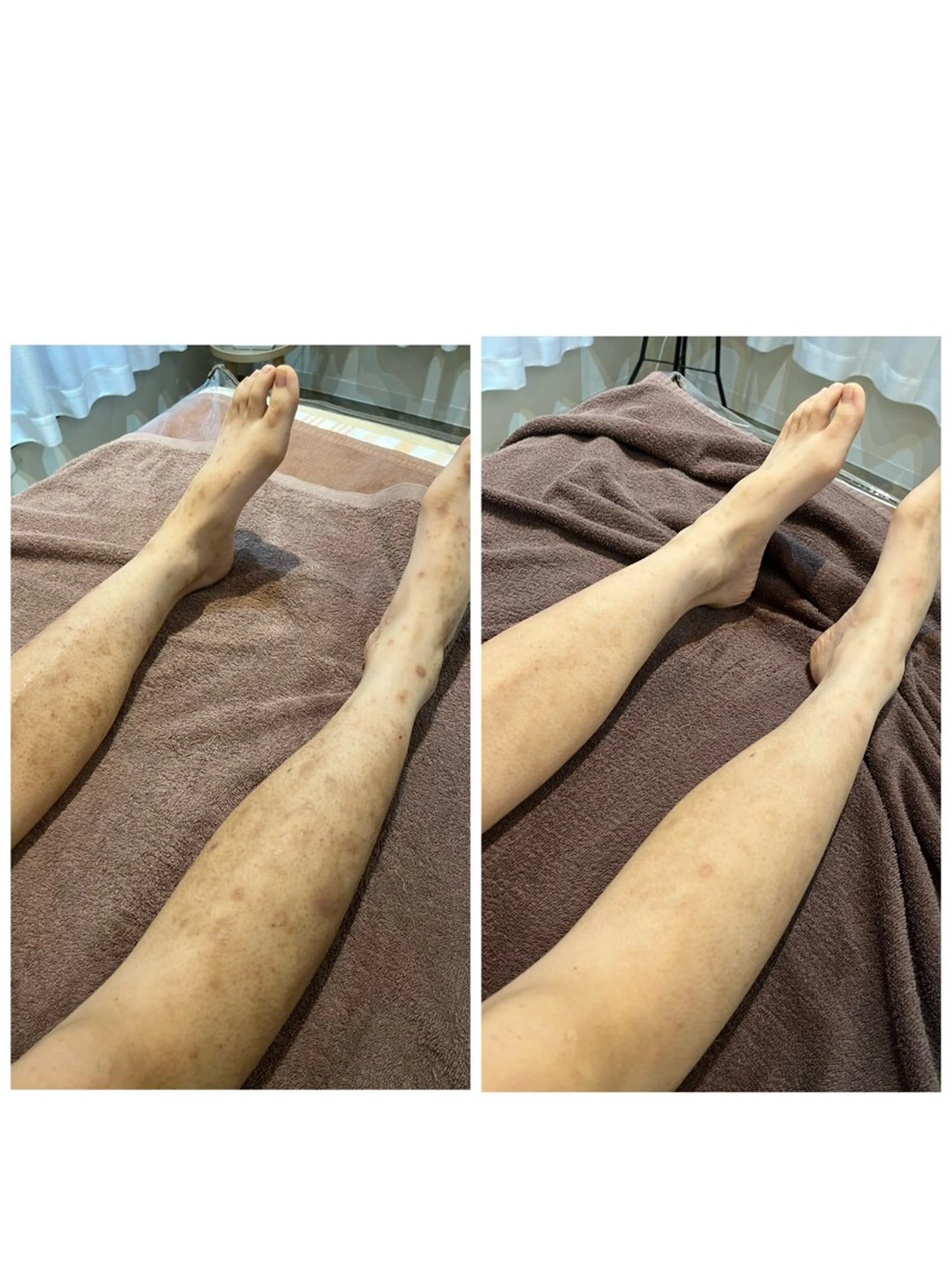 🌺痩身・育乳・ 脱毛ｻﾛﾝ/ｺｵﾘﾅのエステ・リラクイメージ