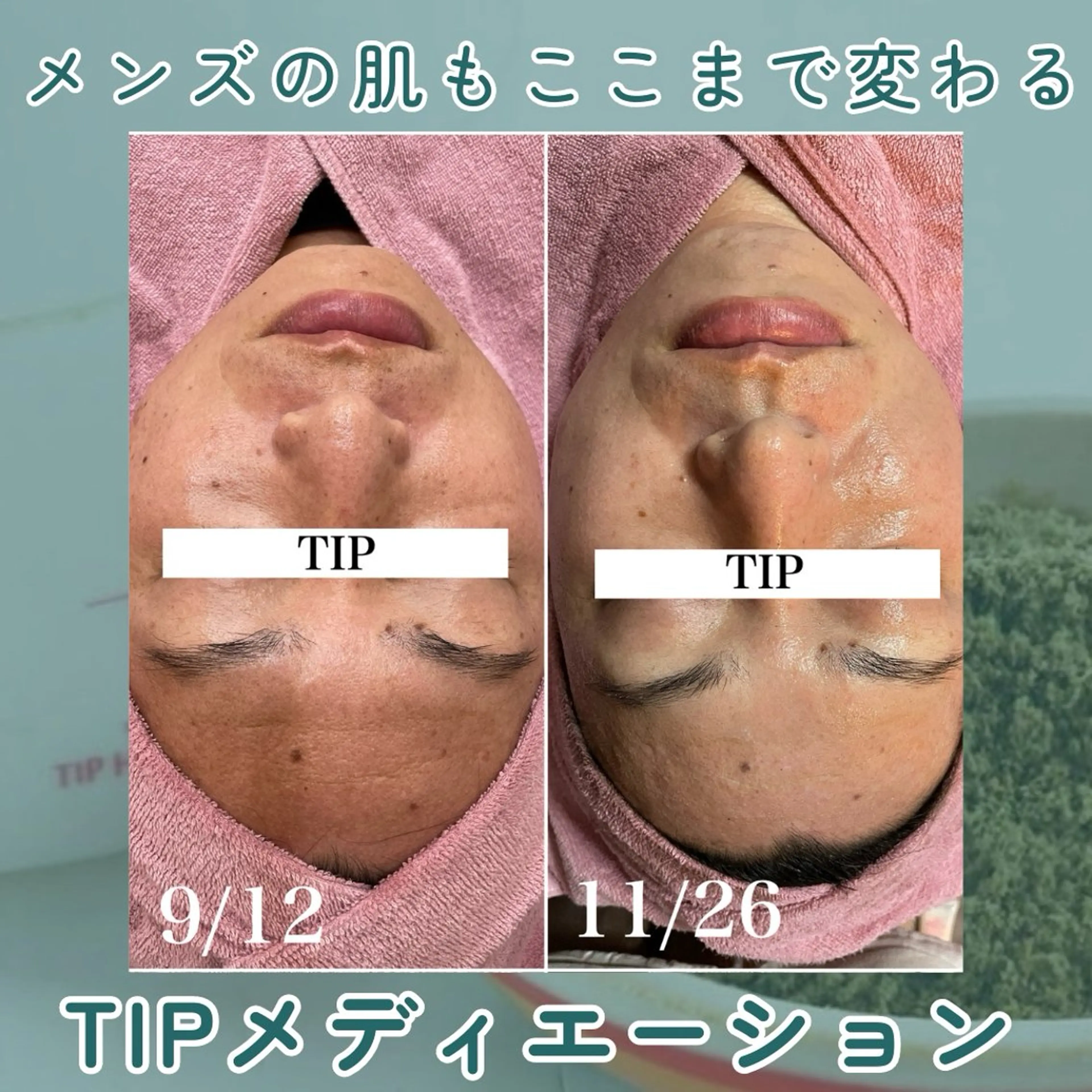 メンズ エステ skin salon enのエステ・リラクイメージ