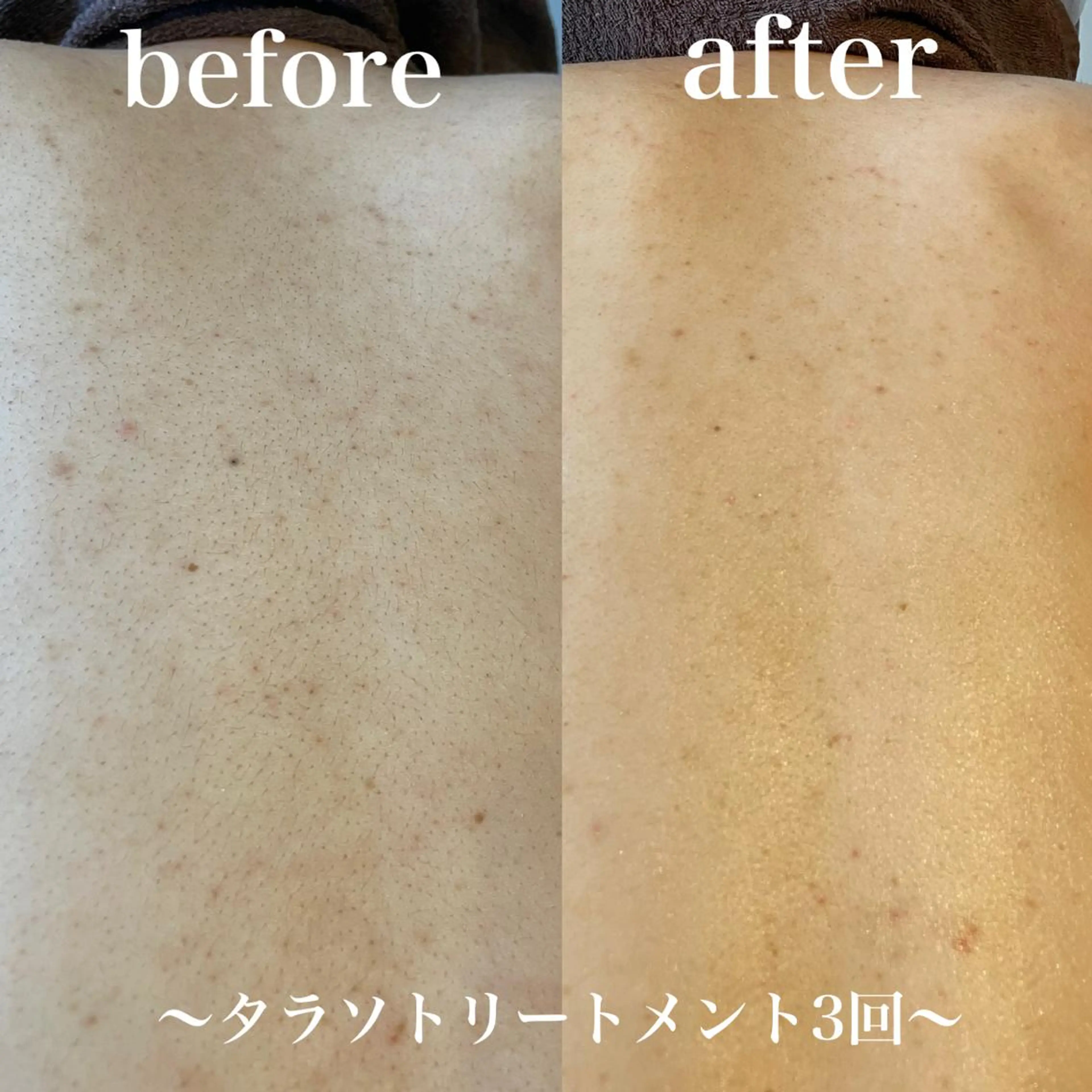 エステ 浜野 恵美のエステ・リラクイメージ