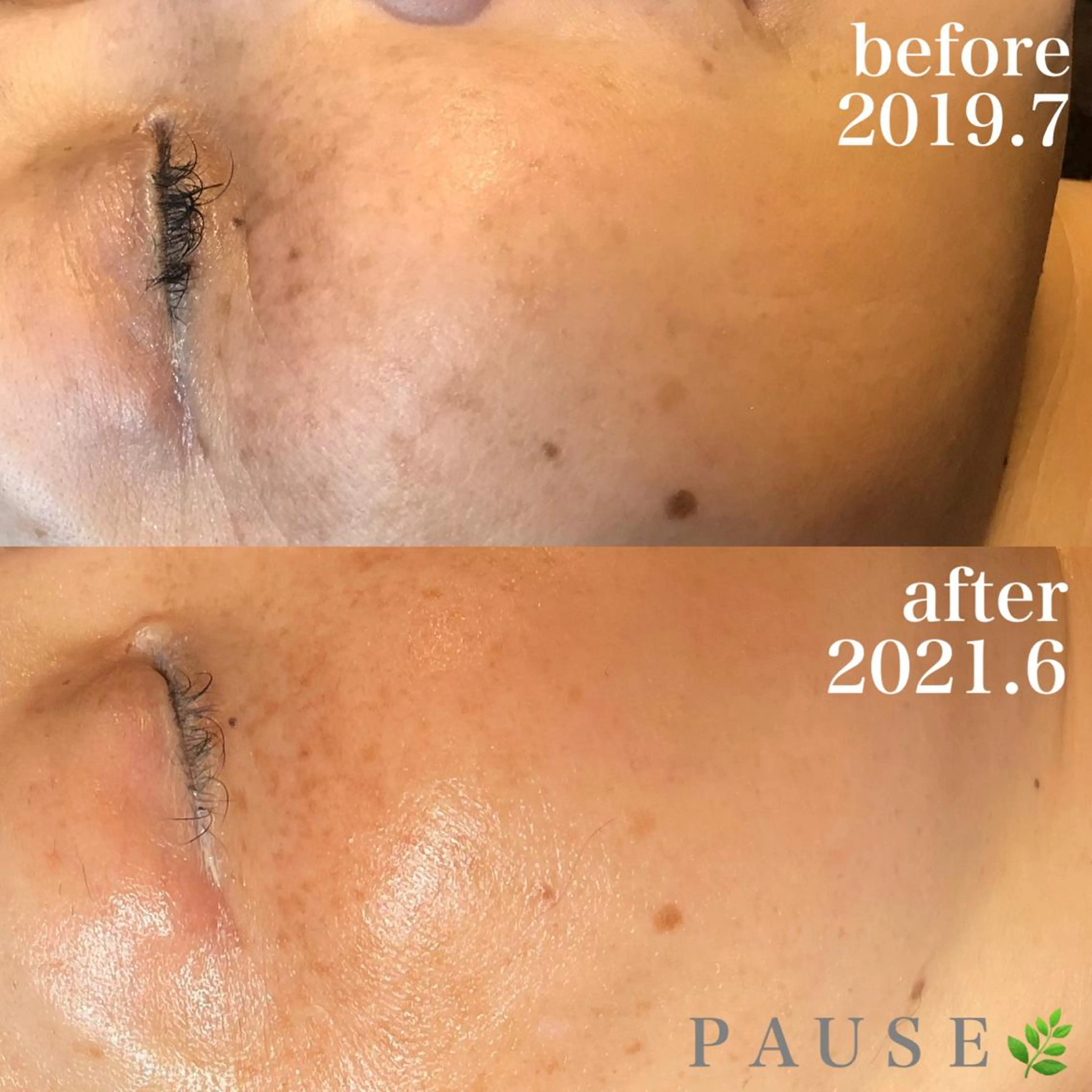 エステ 浜野 恵美のエステ・リラクイメージ