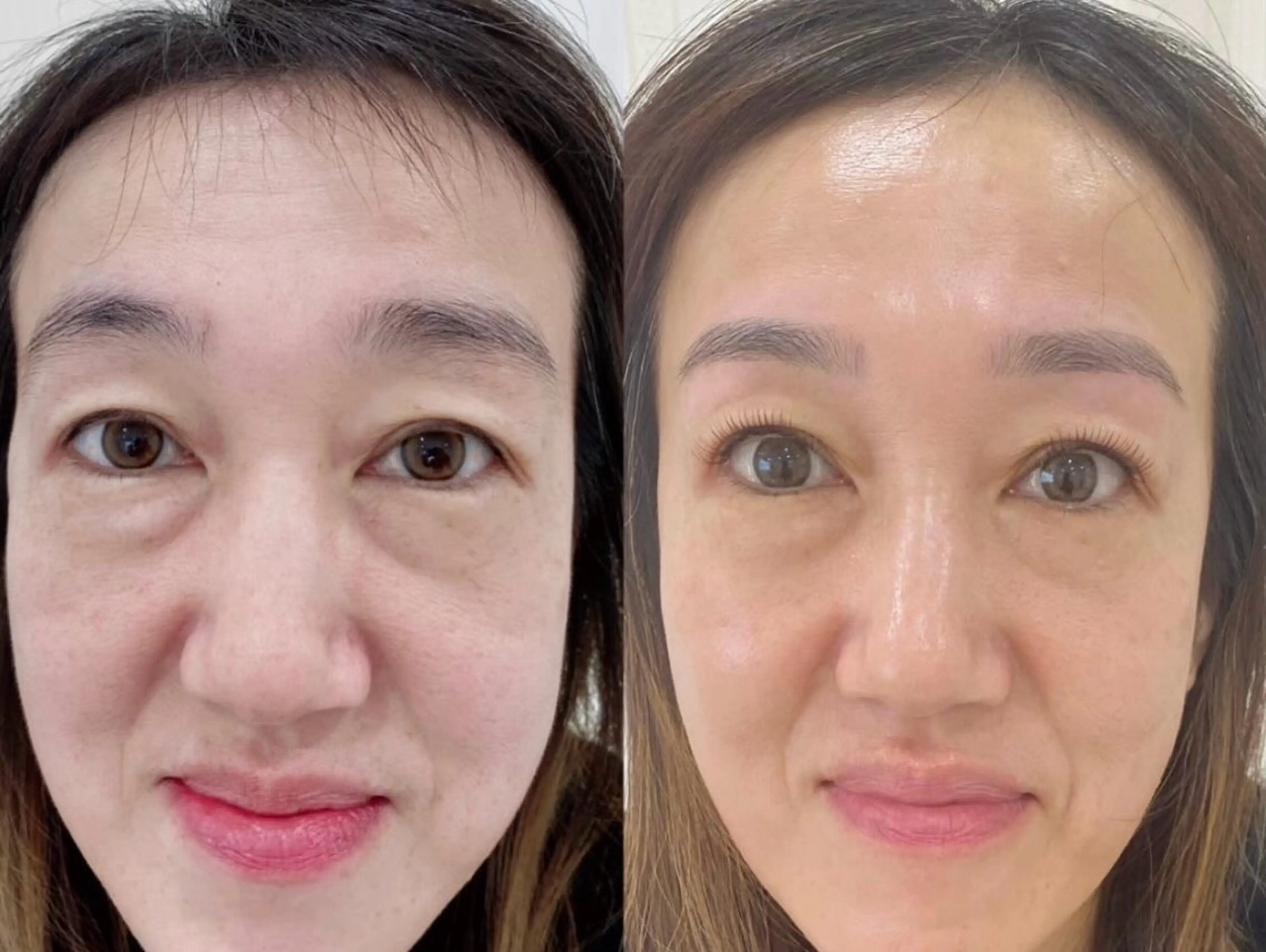 【ご新規様】形状記憶デザインキープラッシュ(LED)140本オフ込みの写真