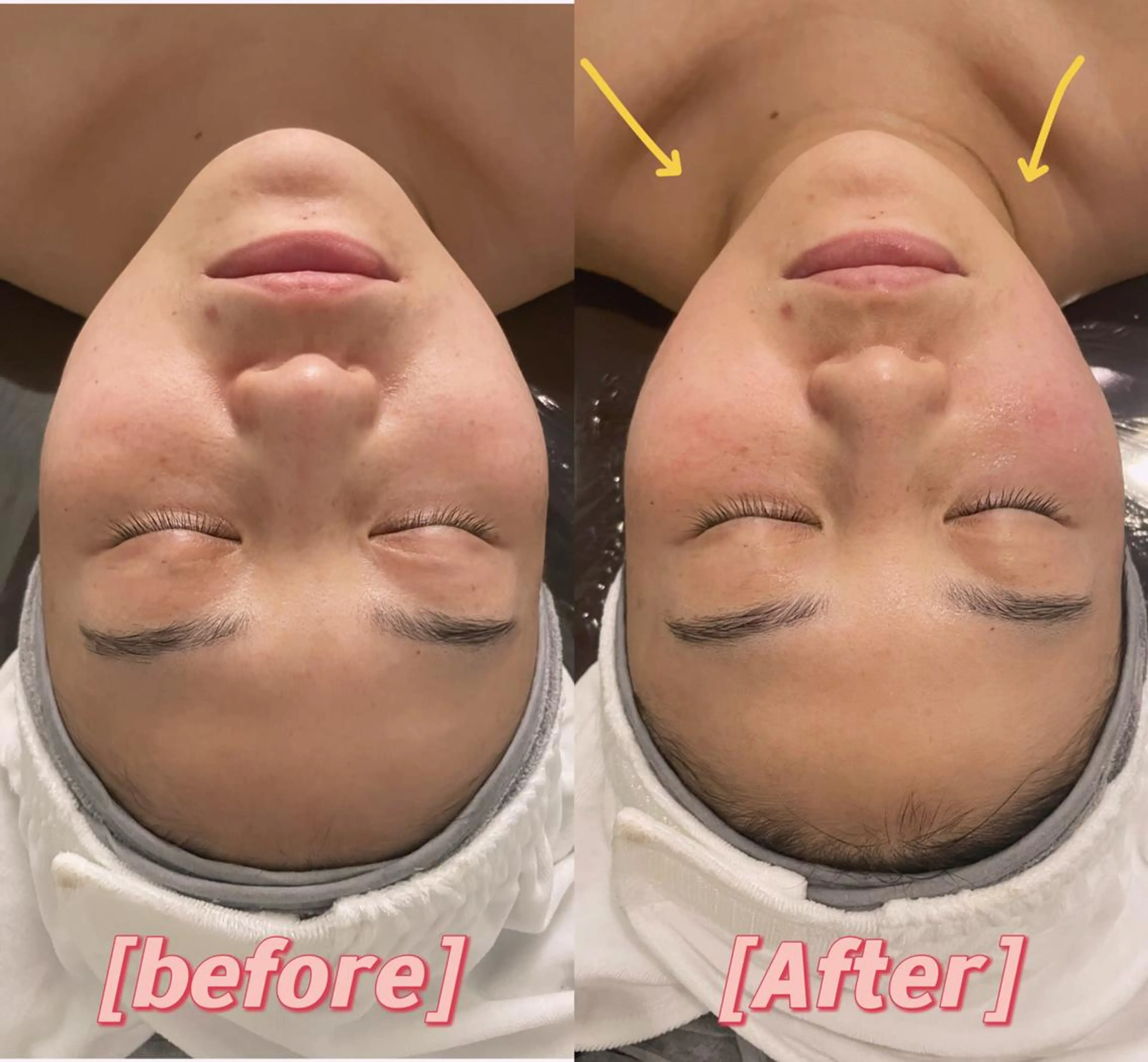 エステ リラク 美肌小顔コルギ&瘦身 KOKOCHIのエステ・リラクイメージ