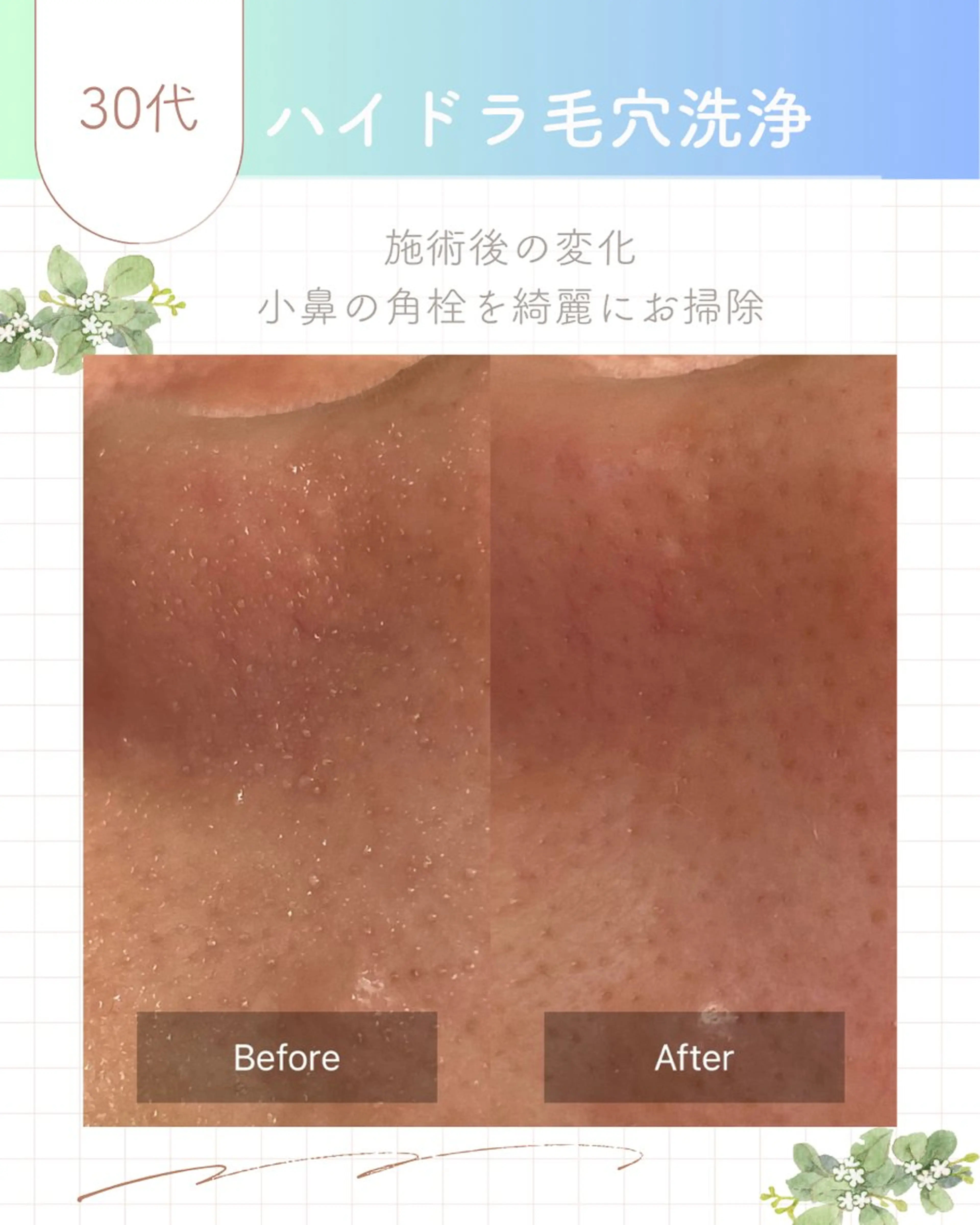 エステ loa まつ毛と肌管理のお店のマツエク・マツパデザイン