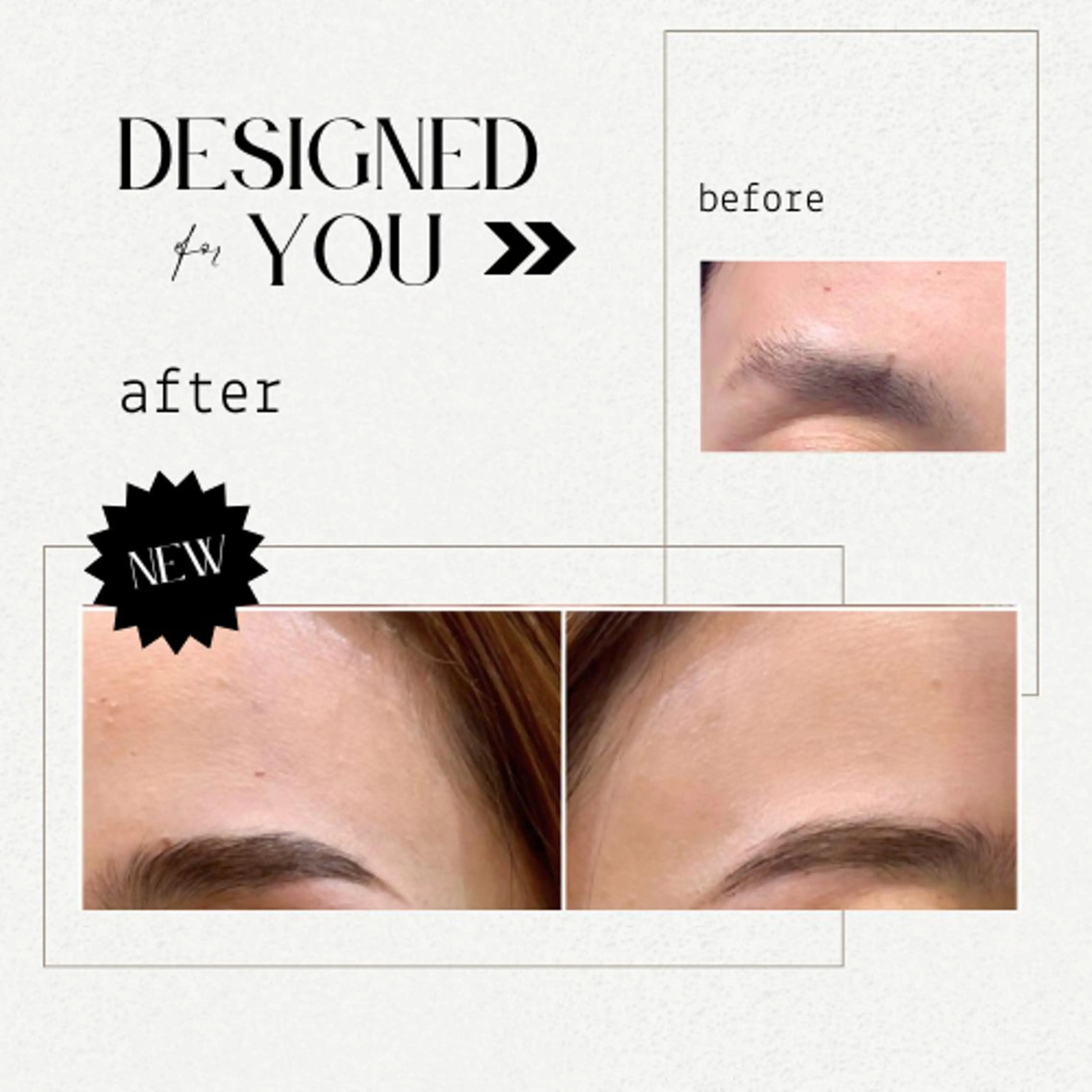 HBL眉毛の毛流れ改善の写真