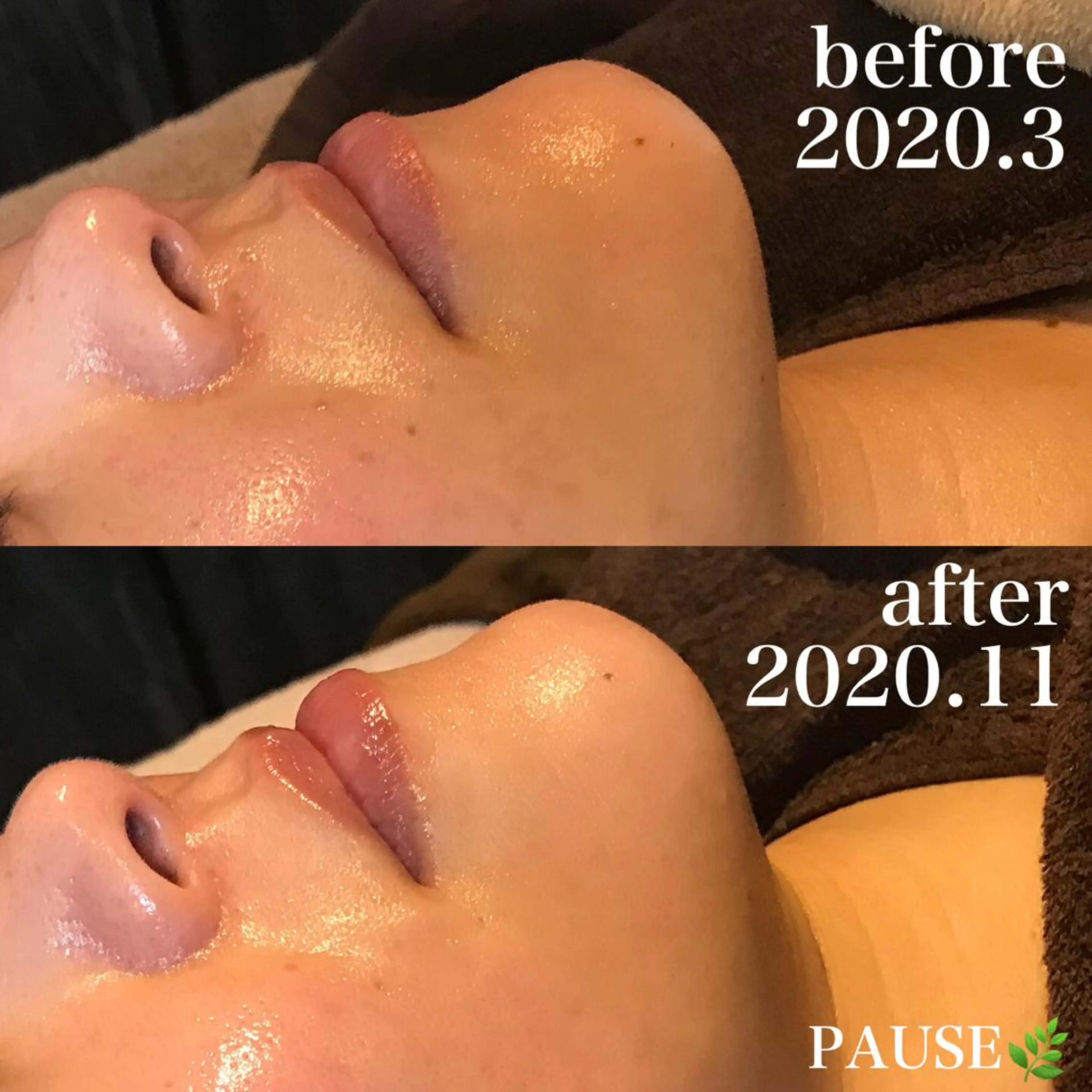 エステ 浜野 恵美のエステ・リラクイメージ