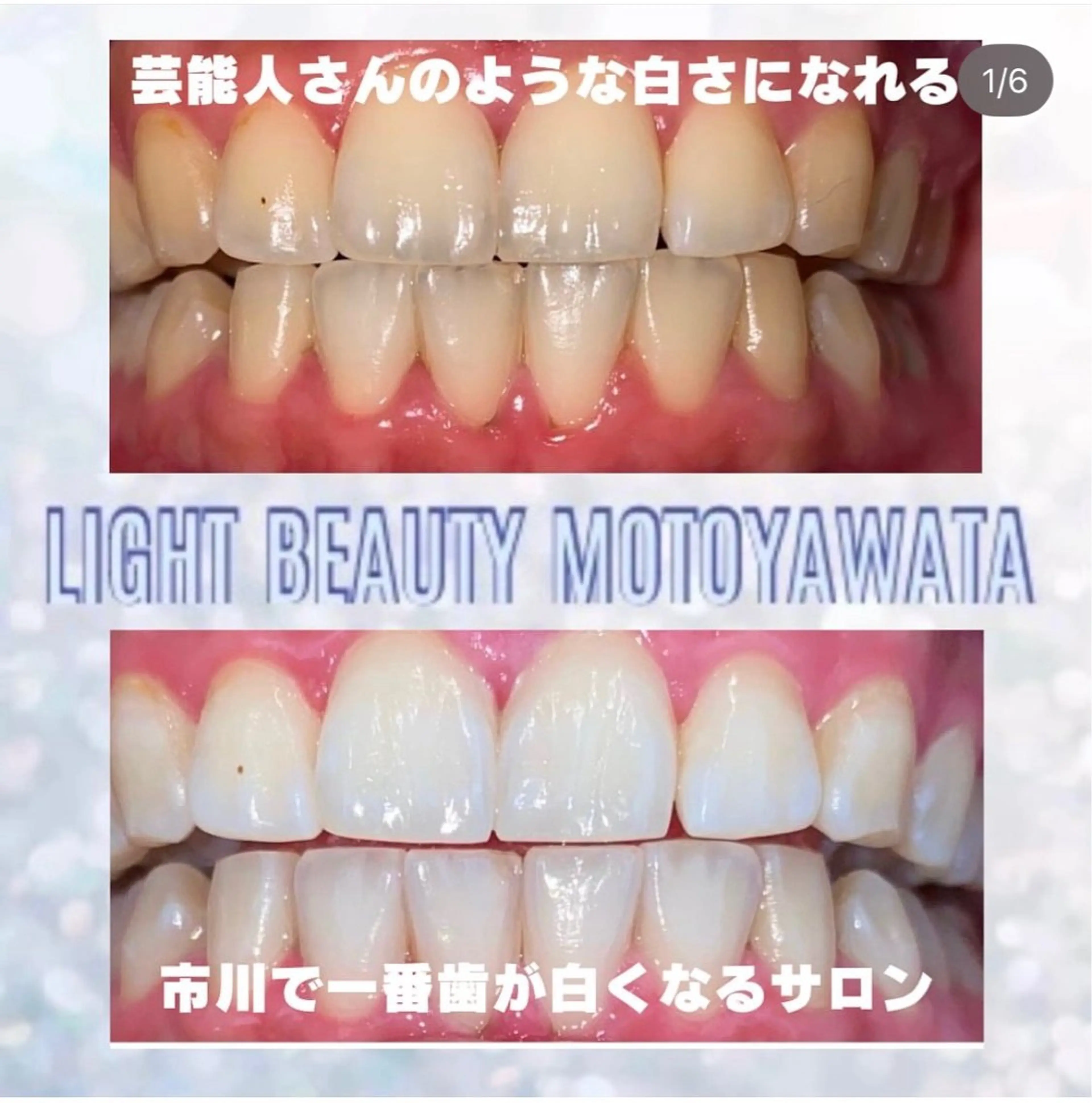 五十嵐 蓮のその他イメージ