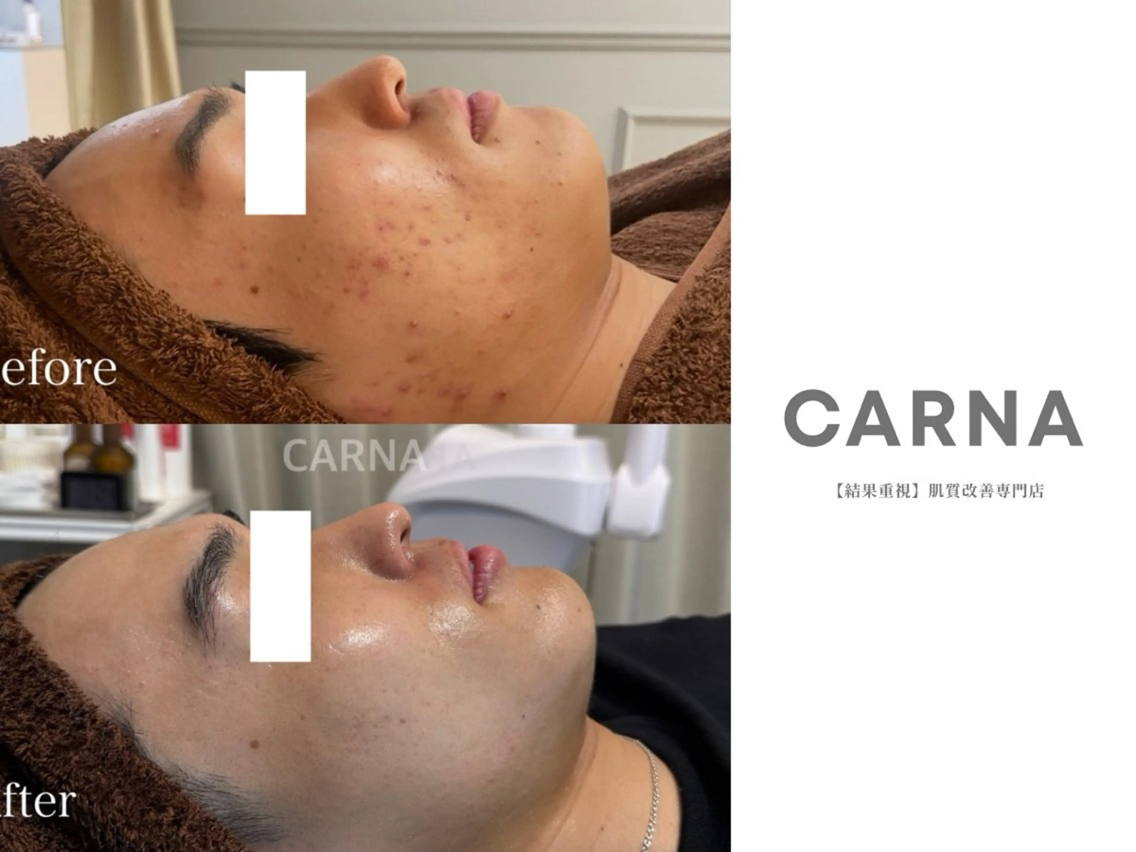 メンズ 【肌質改善専門店】 CARNAのエステ・リラクイメージ