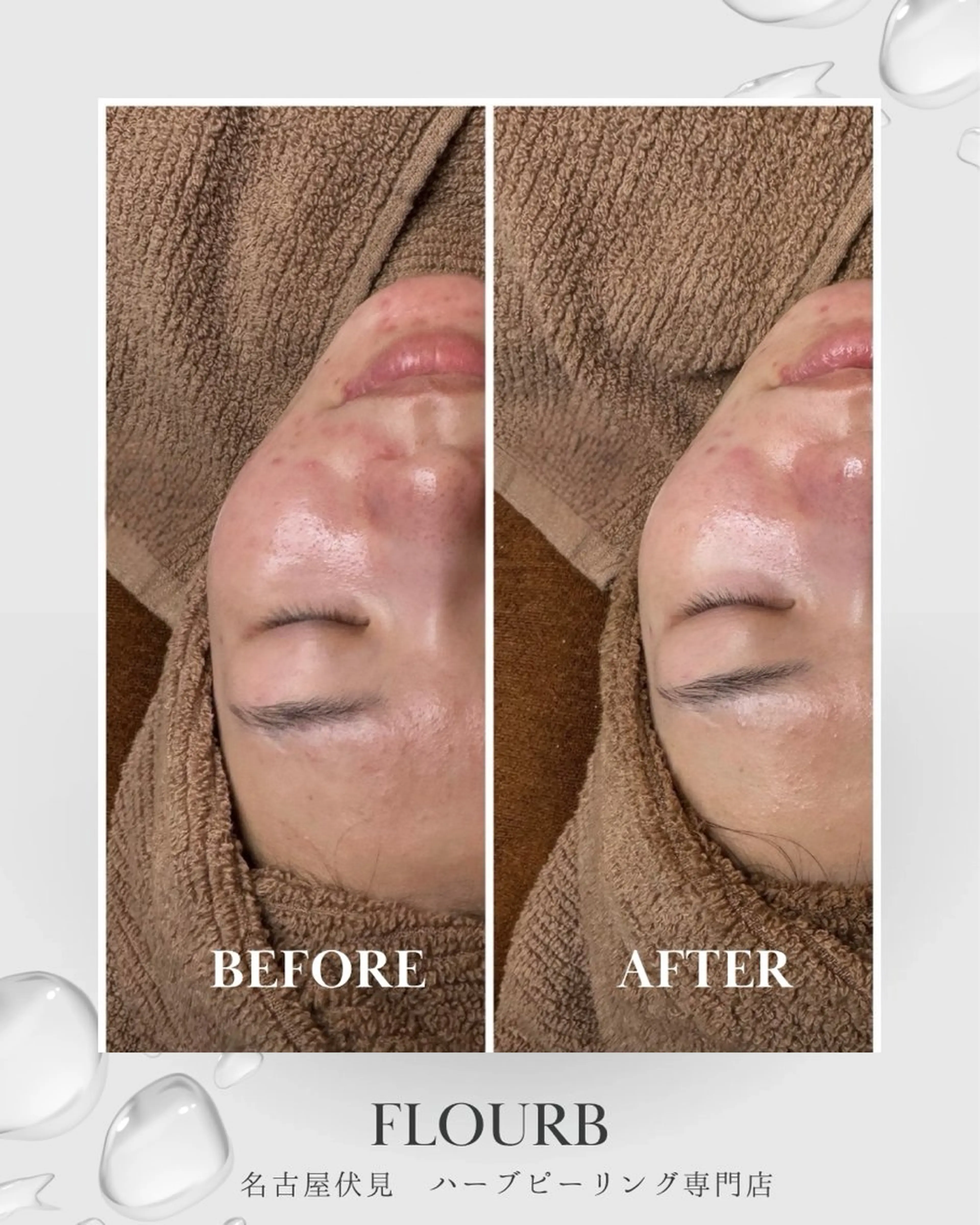 エステ Flourb所属・ハーブピーリング専門 サロンFlourbのエステ・リラクイメージ