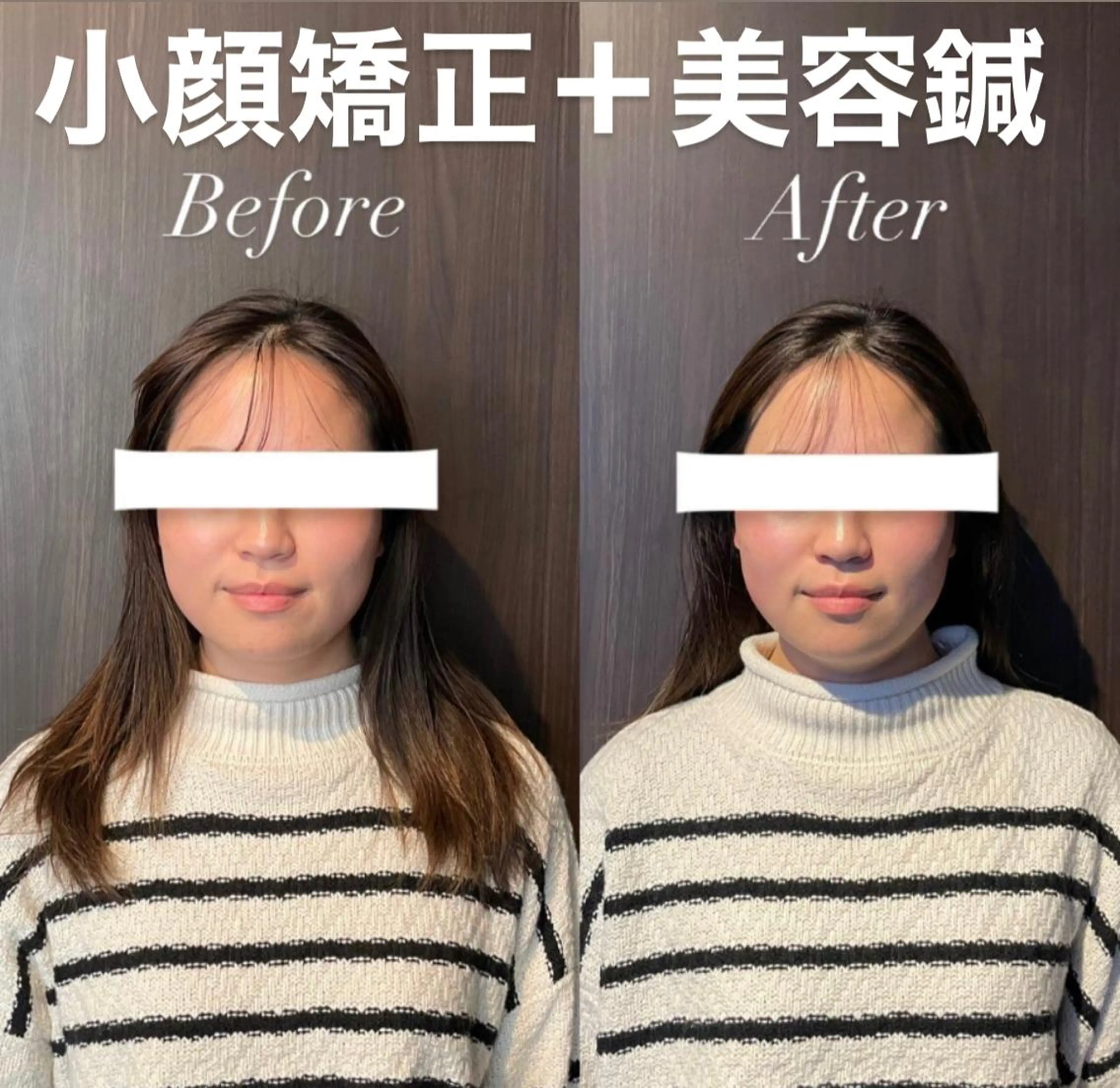 つばさ所属・マッツンの 鍼のその他イメージ