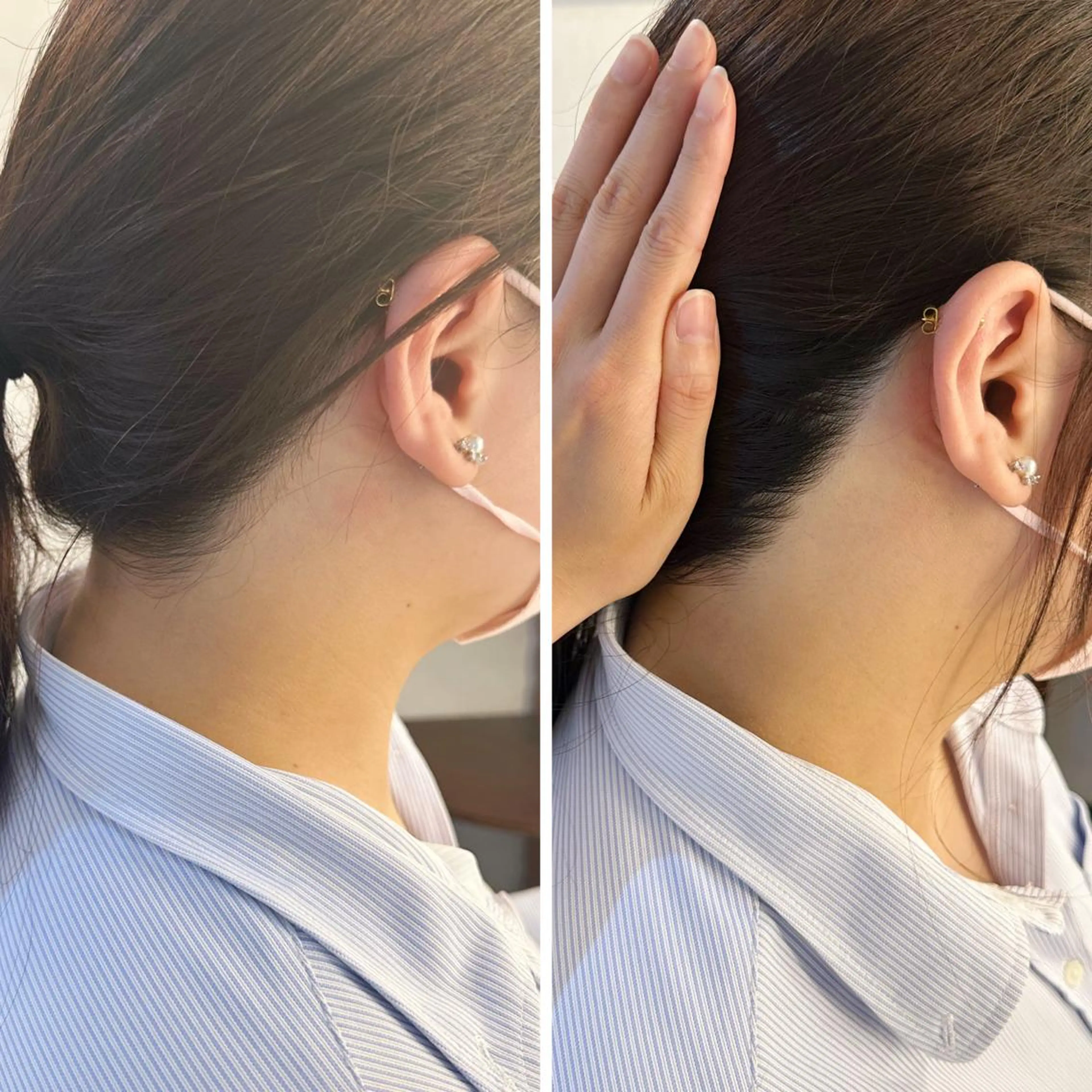 うなじ脱毛/美肌脱毛 LABELのエステ・リラクイメージ