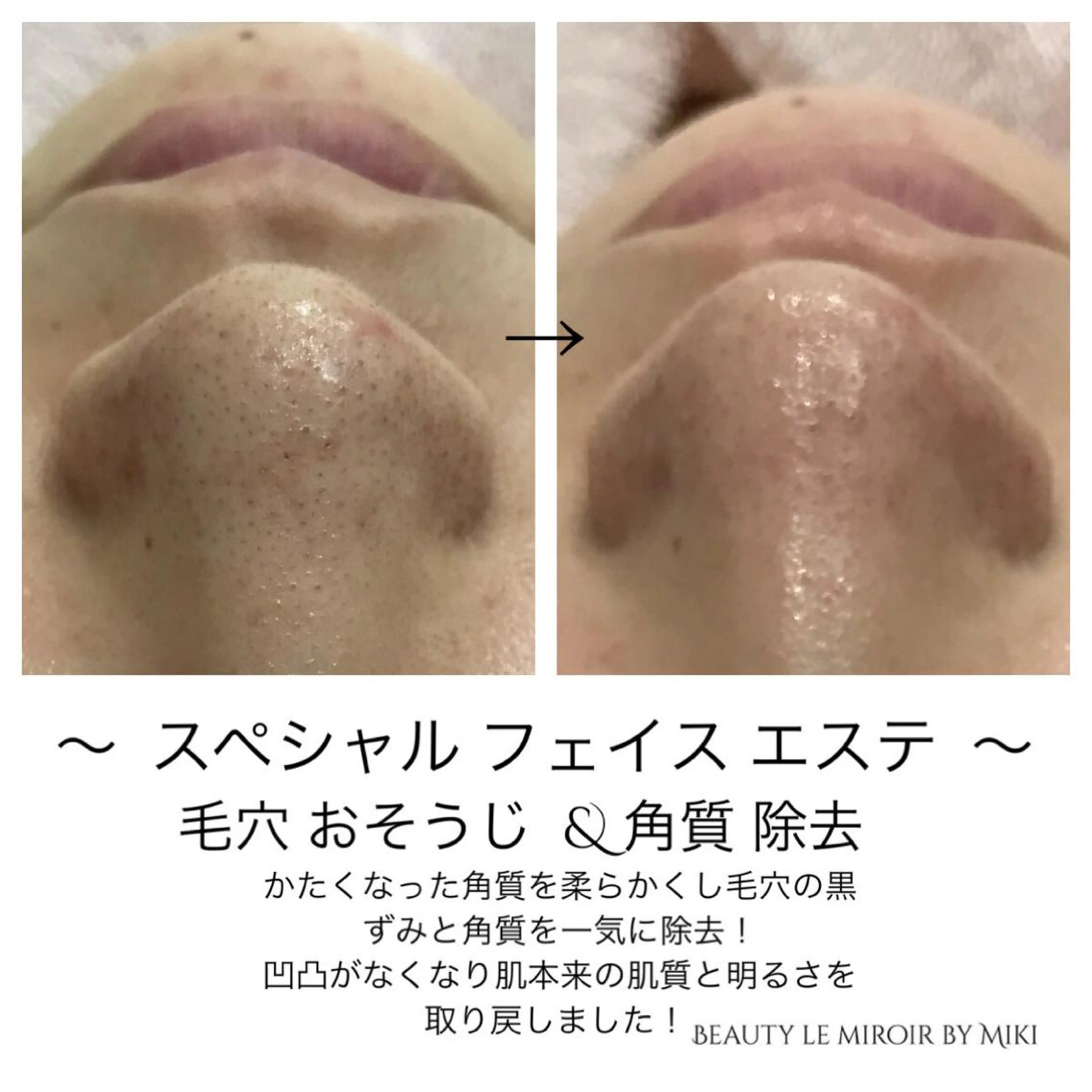 ビューティー ミロワールのエステ・リラクイメージ