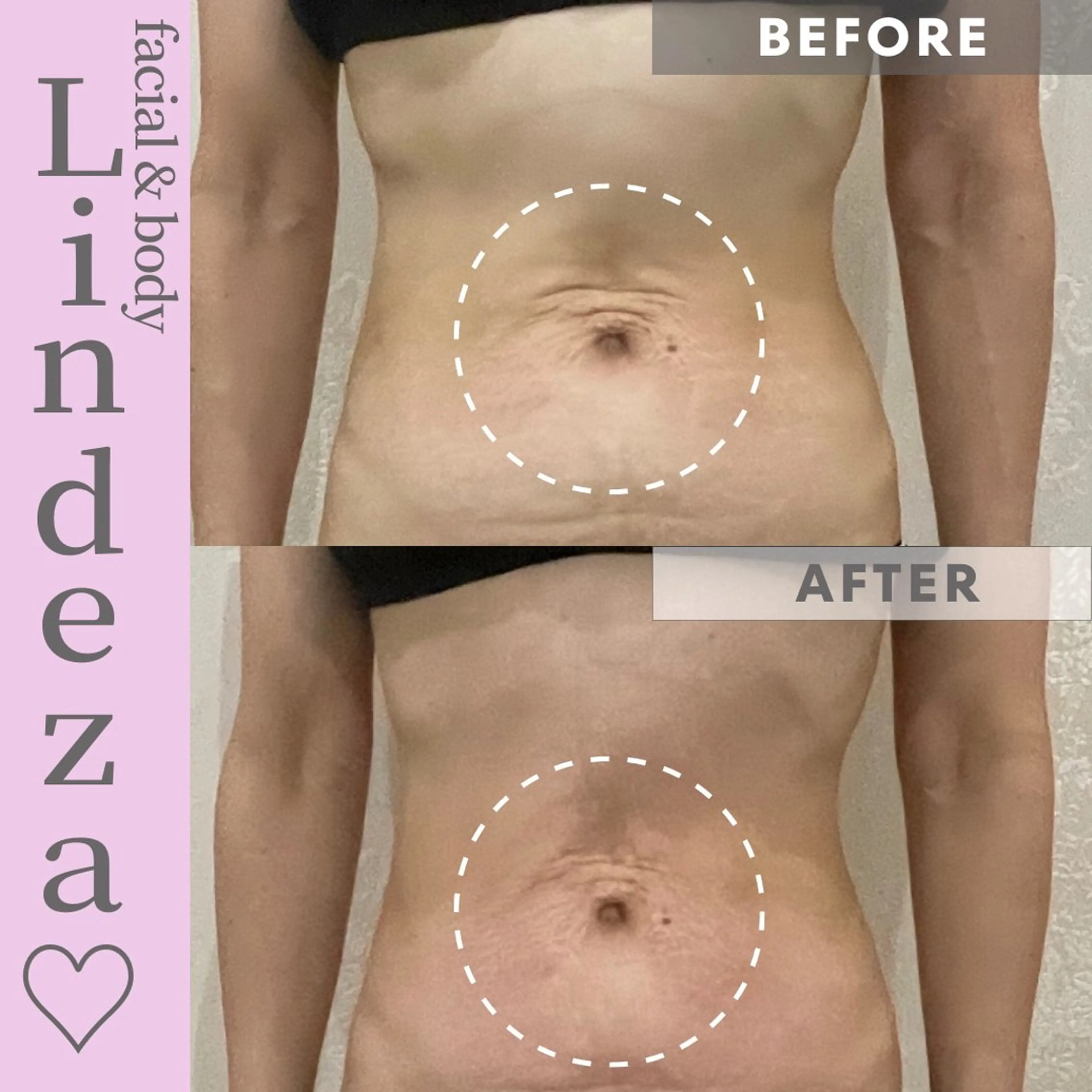 リンデザ 山口のエステ・リラクイメージ