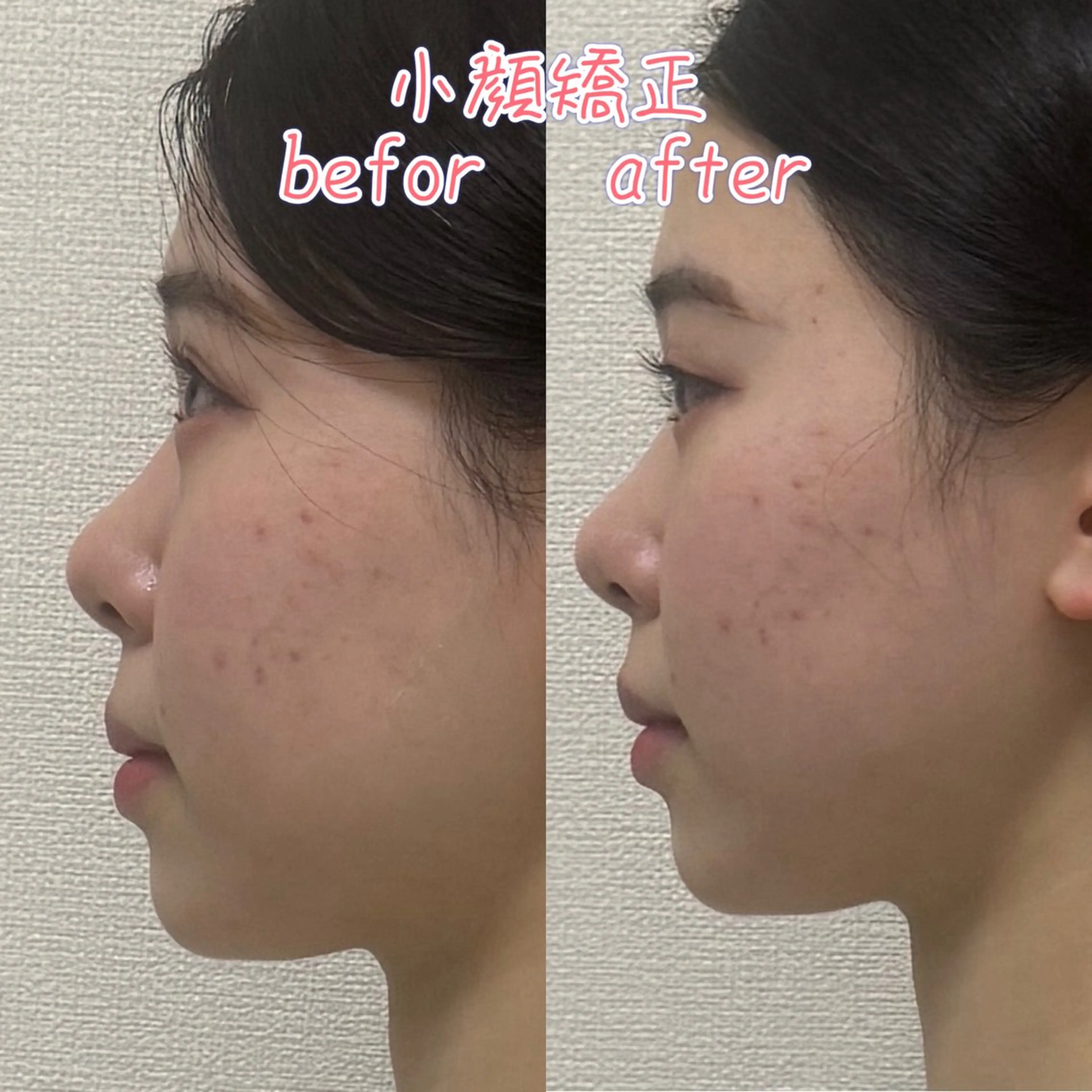 リラク 美骨矯正サロン　メディカルカイロテルボ所属・田中 輝寿のエステ・リラクイメージ