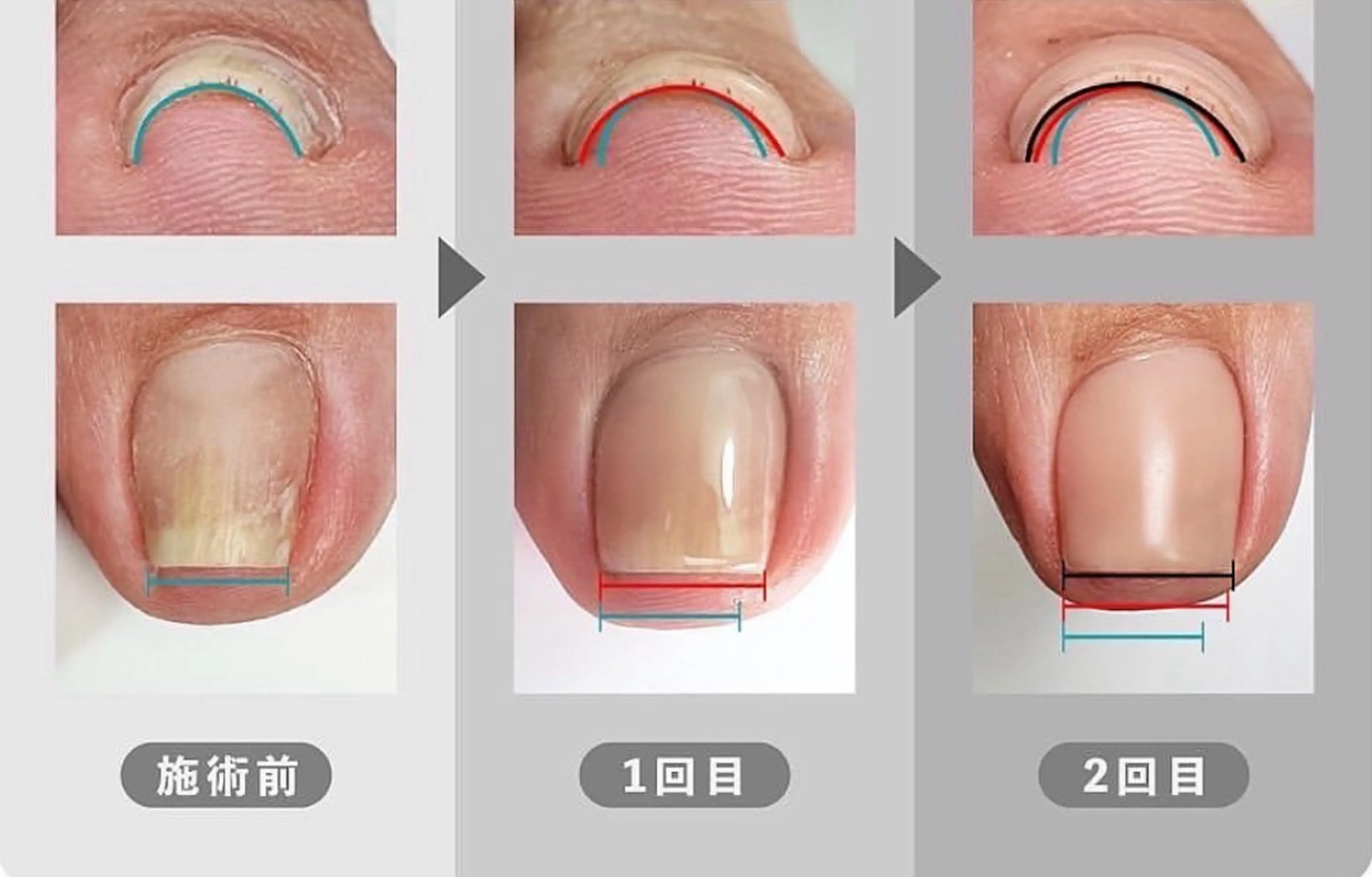 ネイル ジェルネイル その他(ネイル) NAILSALON IROのネイルデザイン