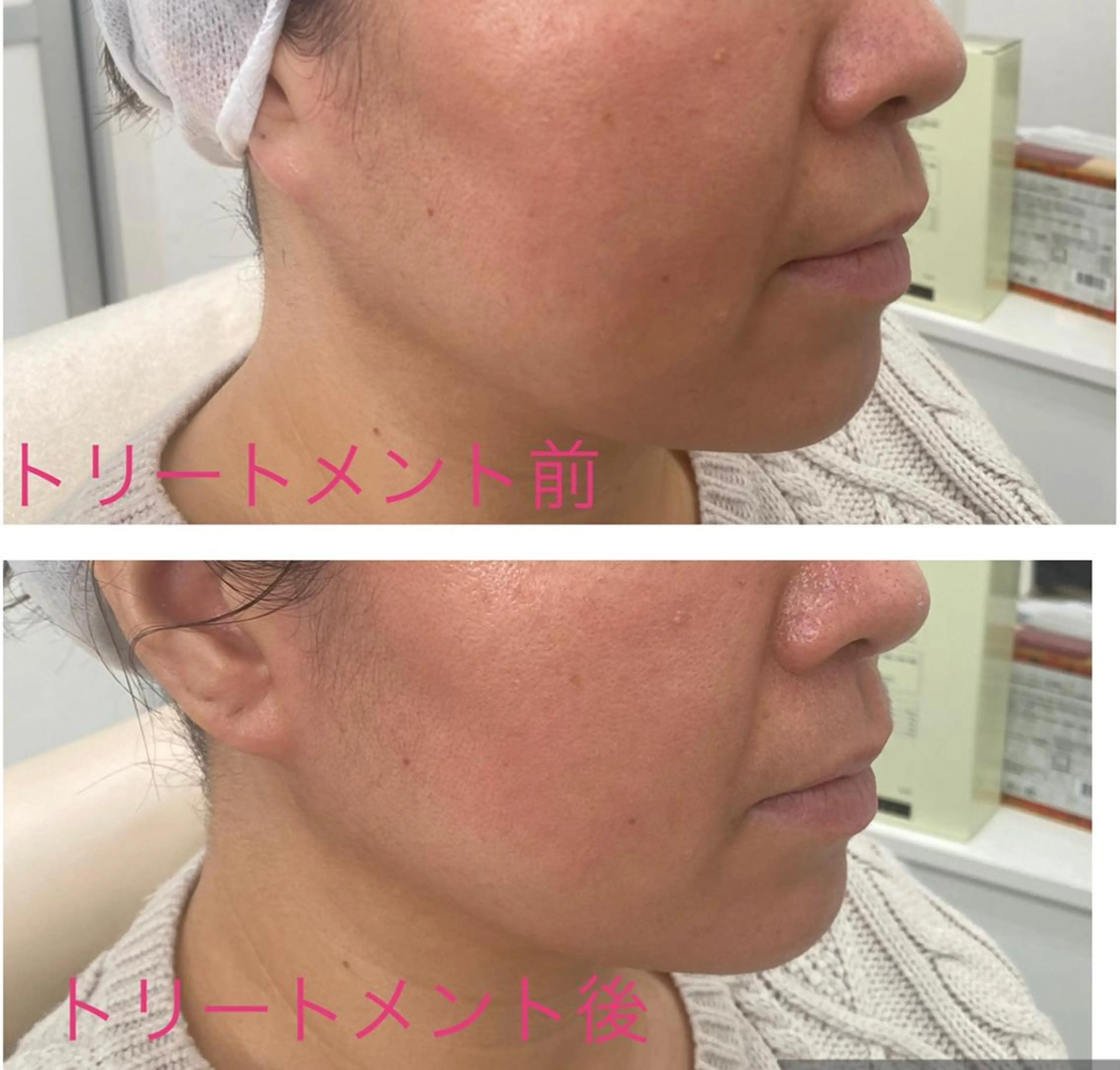 エステ ノエビア ラボーテサロンのエステ・リラクイメージ