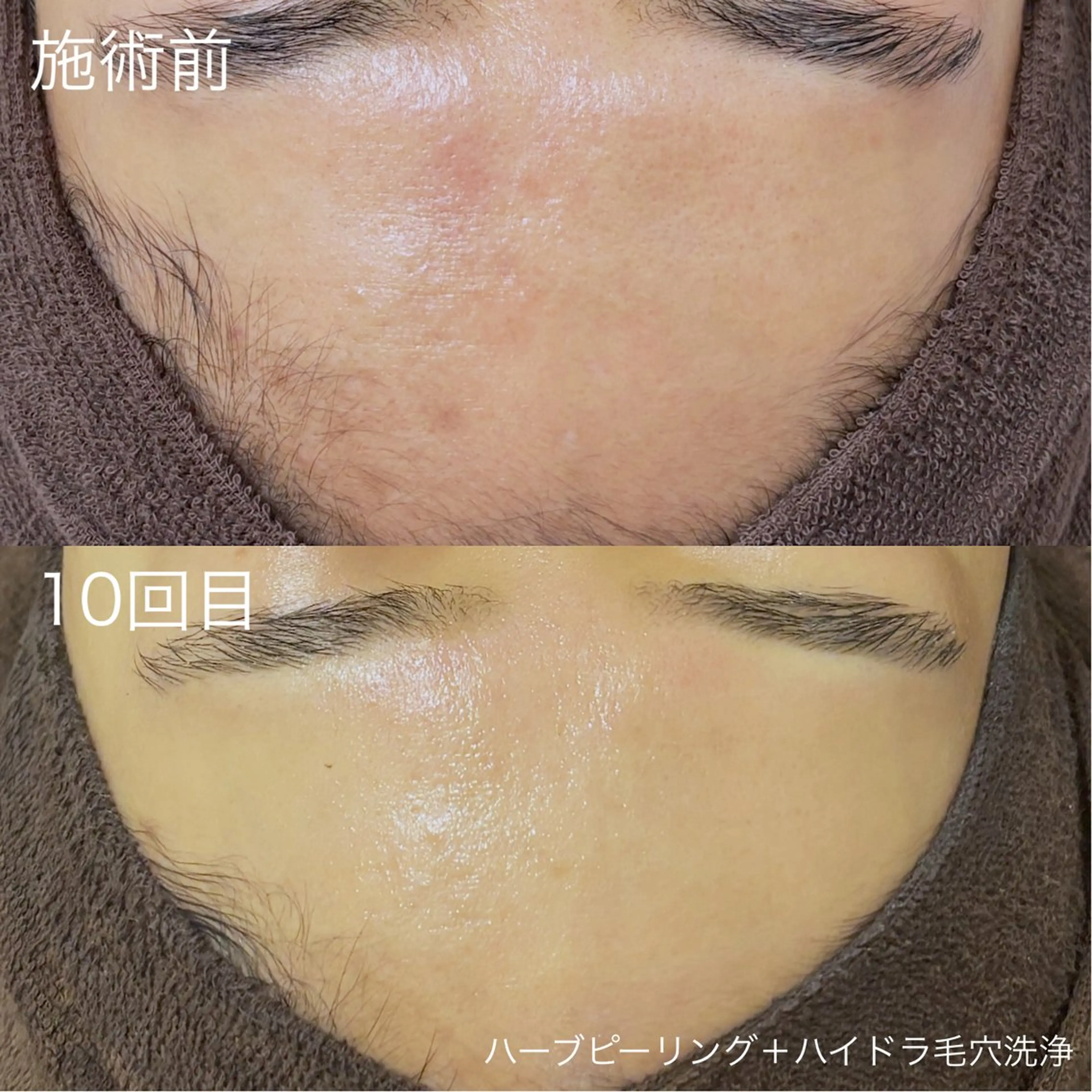 脱毛 lulula ricoのエステ・リラクイメージ