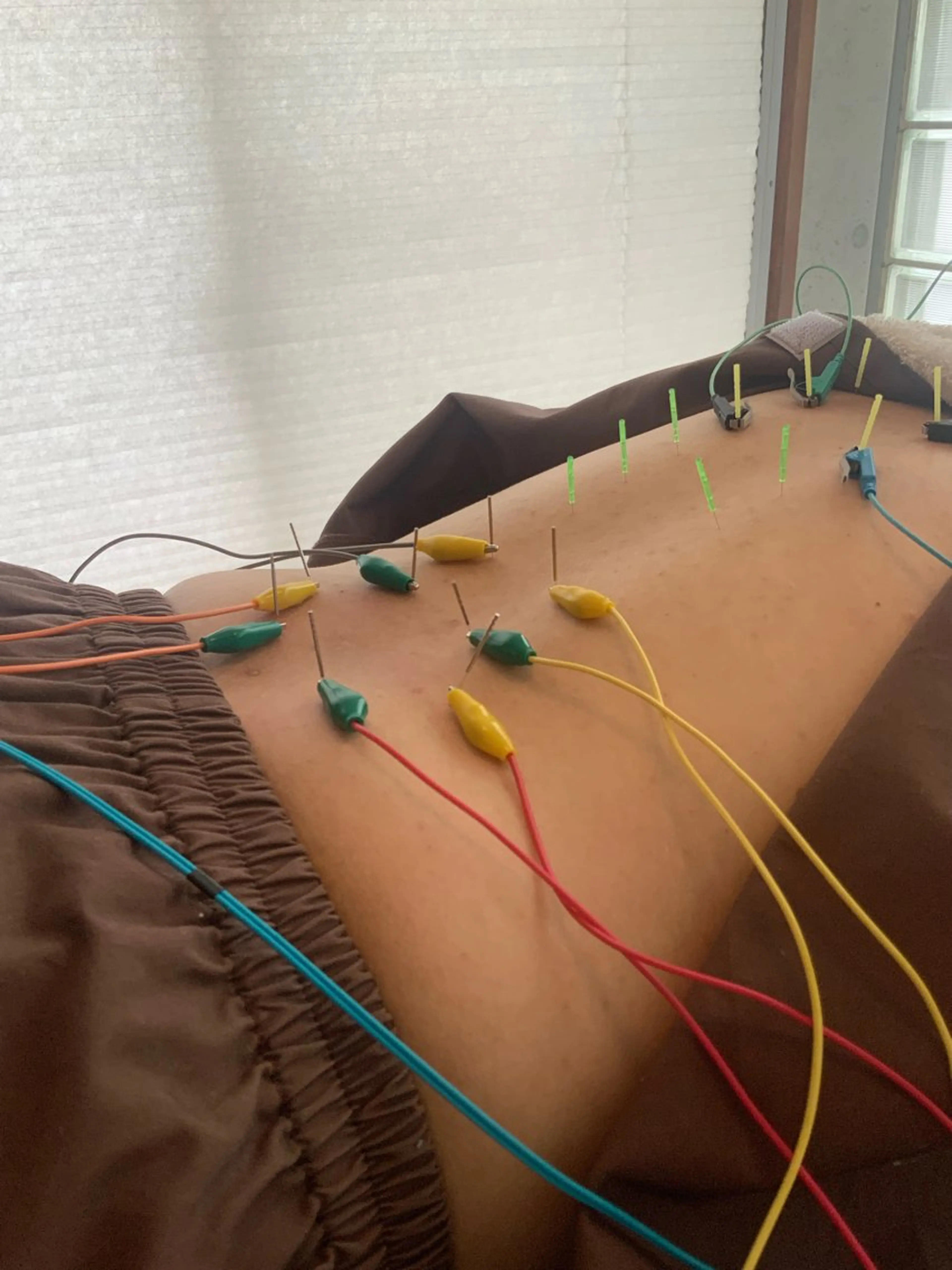 うめきた鍼灸院 SENSEのエステ・リラクイメージ