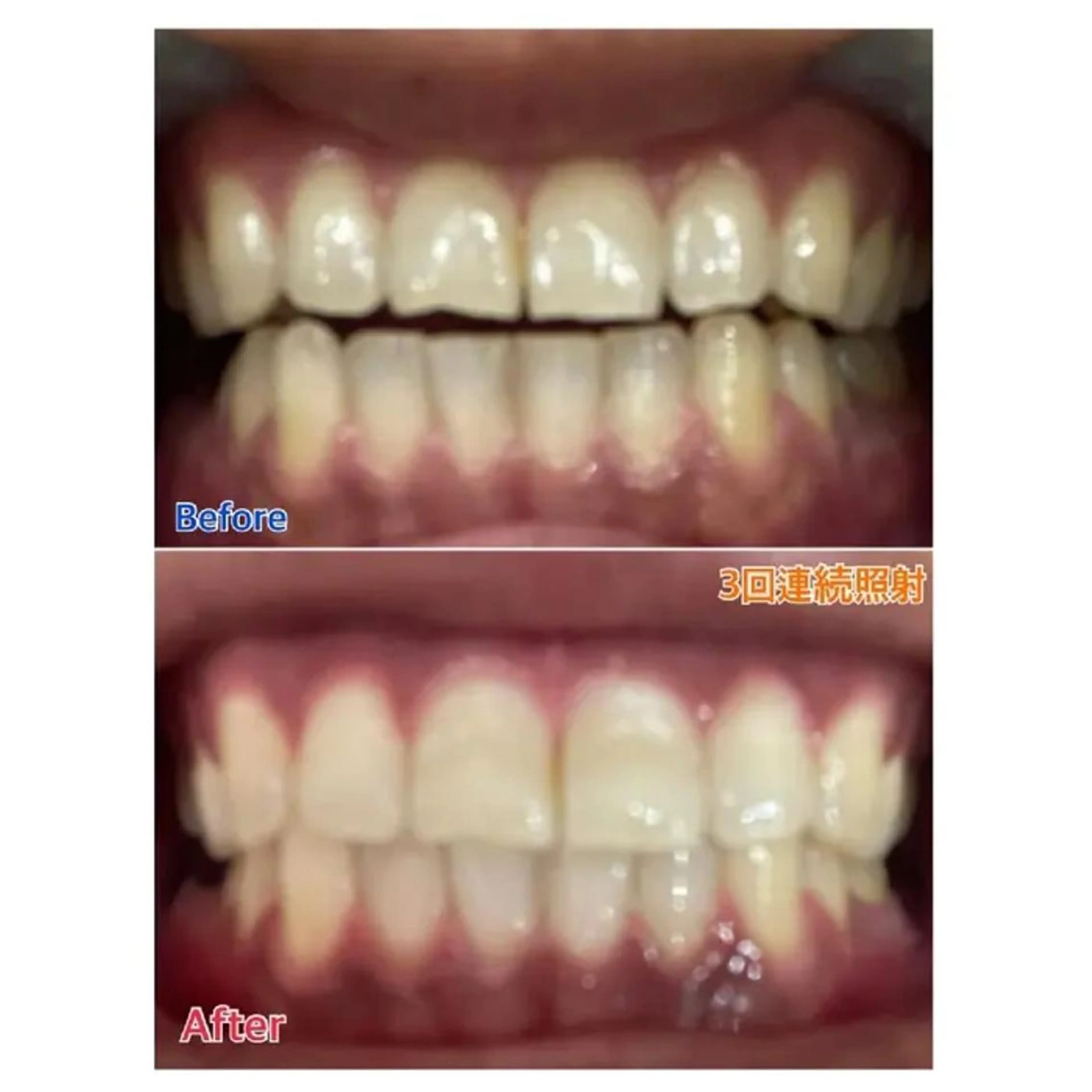 Ｍ渋谷 ホワイトニングのエステ・リラクイメージ