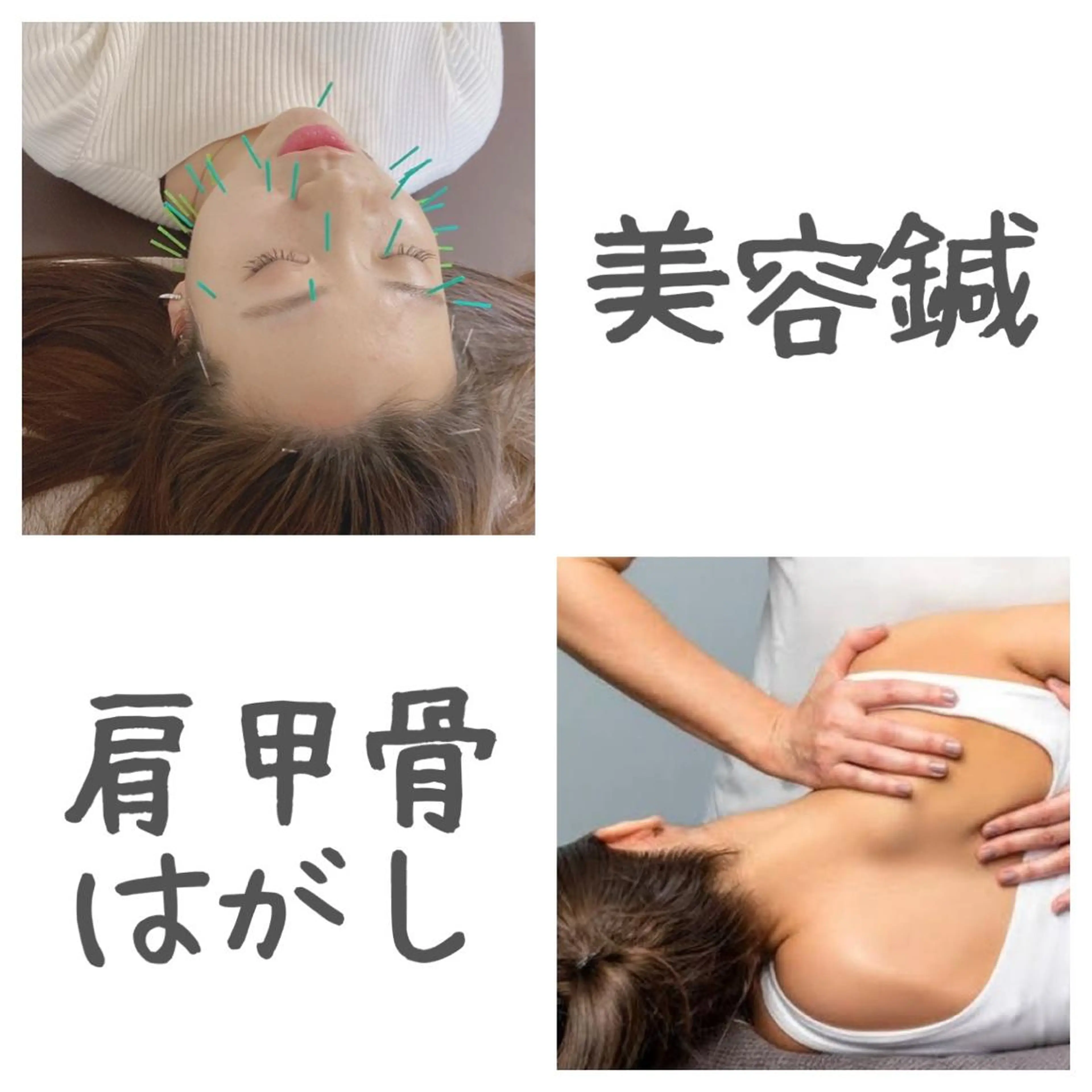 背中がお疲れの方💜美容鍼&肩甲骨はがし&鎖骨リンパ流しの写真